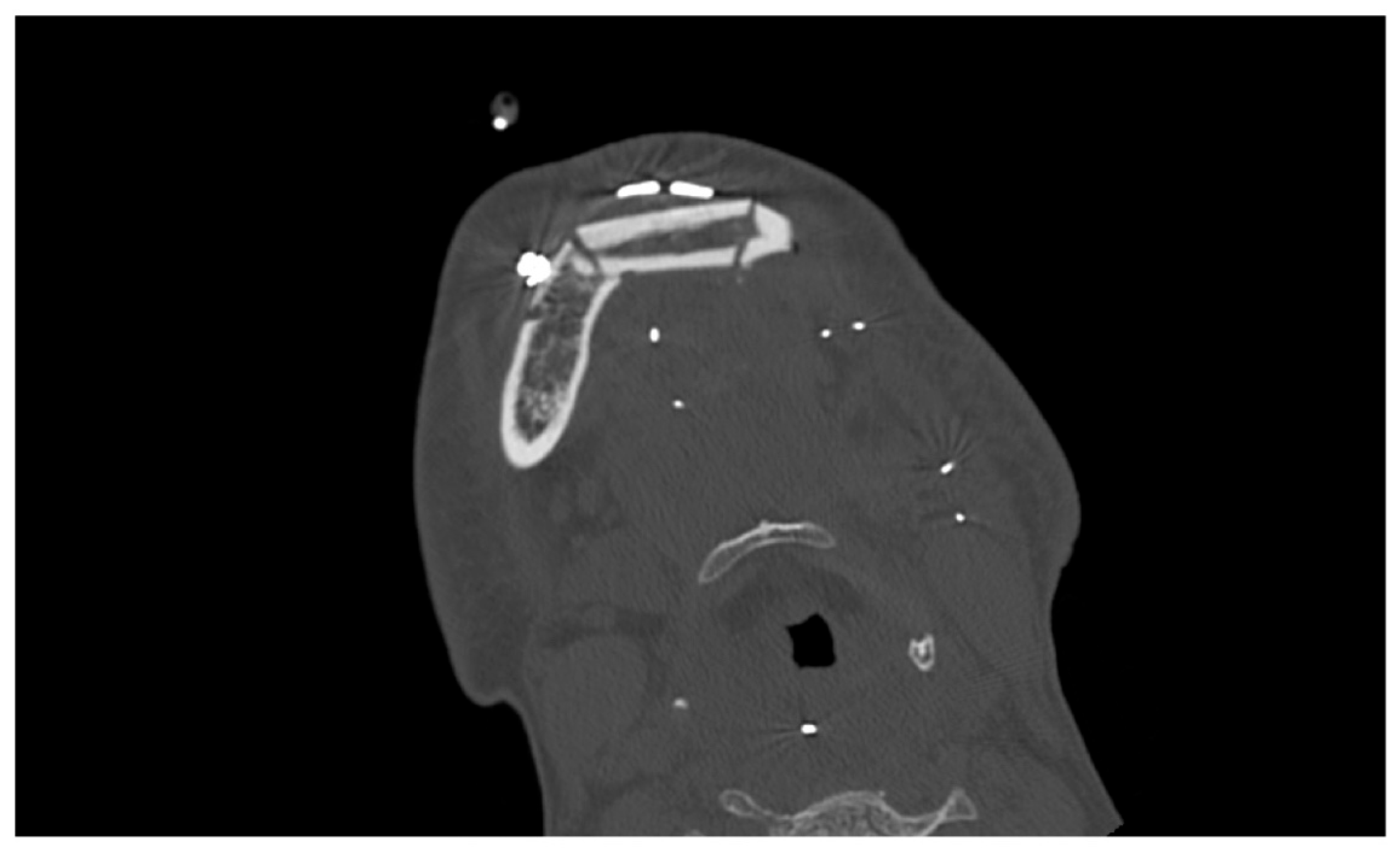 Oral 05 00057 g004 Oral 05 00057 g004