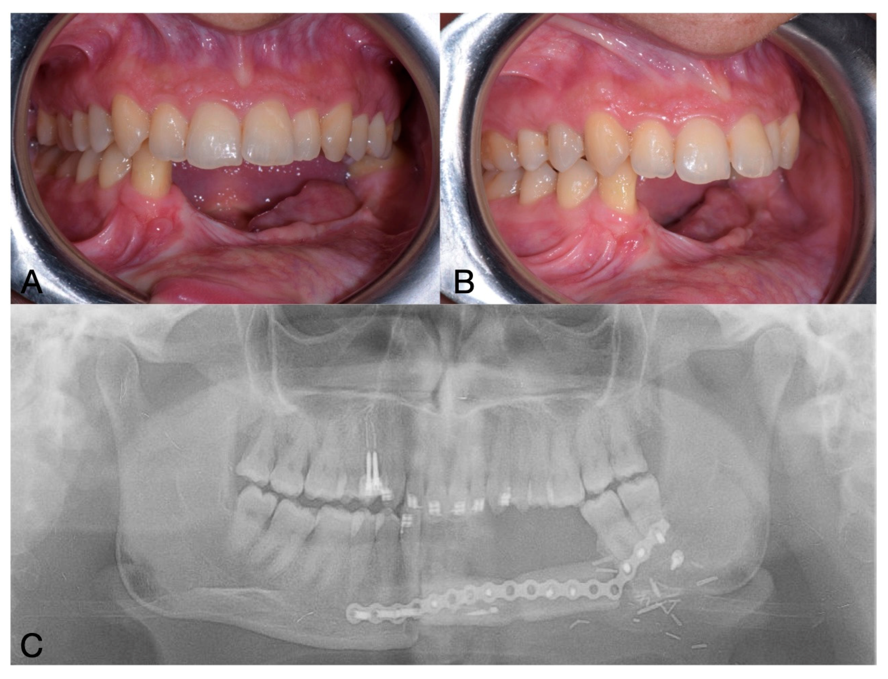 Oral 05 00057 g005 Oral 05 00057 g005