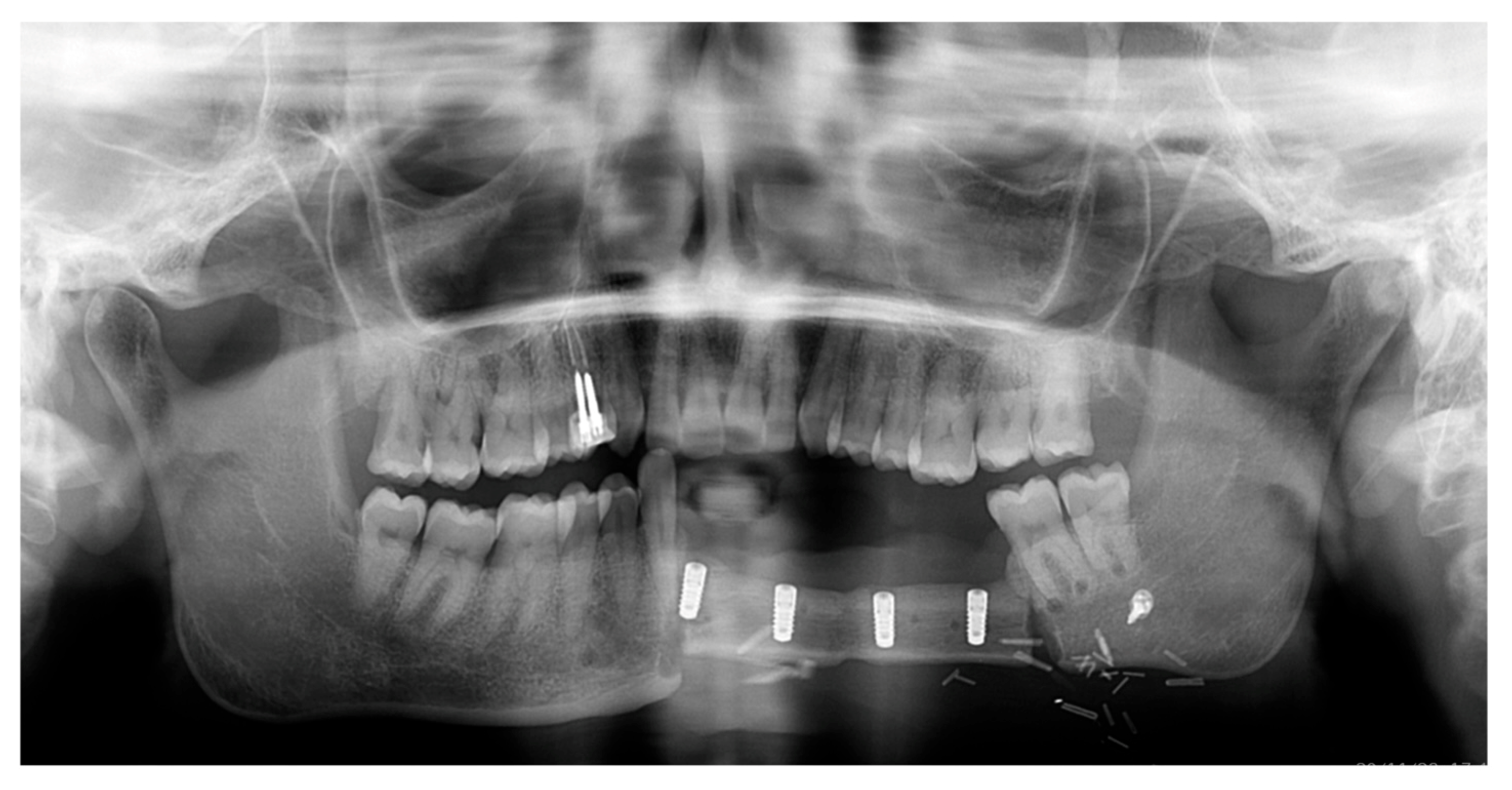 Oral 05 00057 g006 Oral 05 00057 g006
