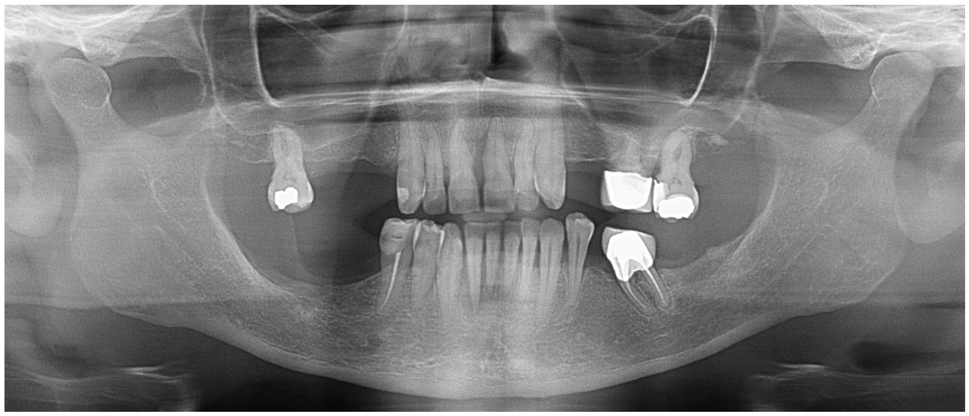 Oral 06 00085 g002 Oral 06 00085 g002