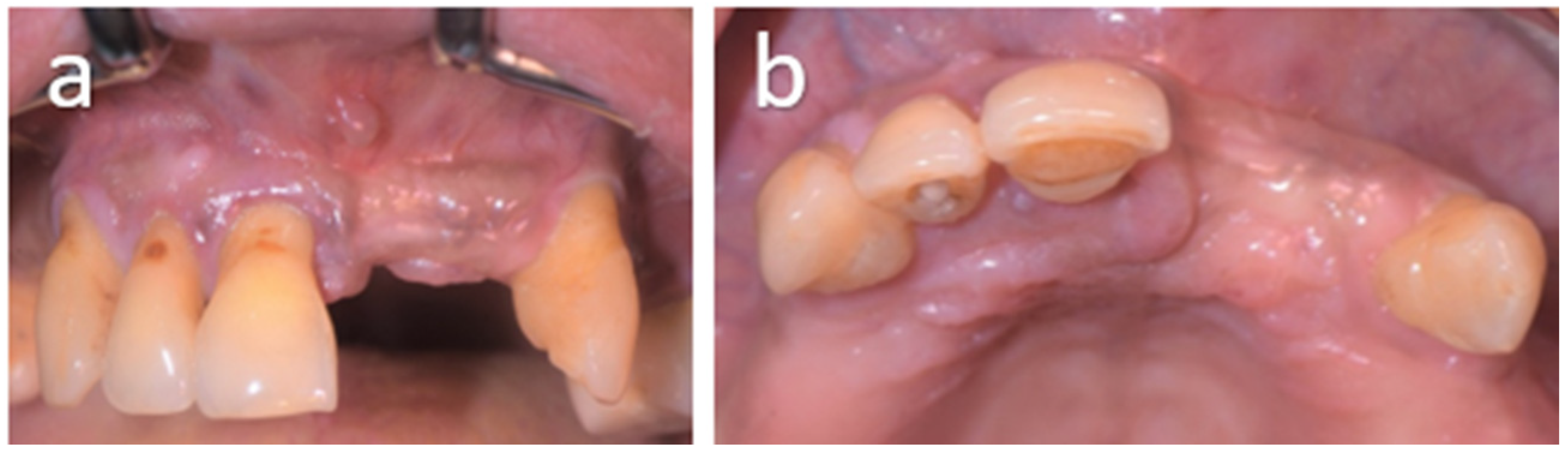 Oral 06 00085 g004 Oral 06 00085 g004
