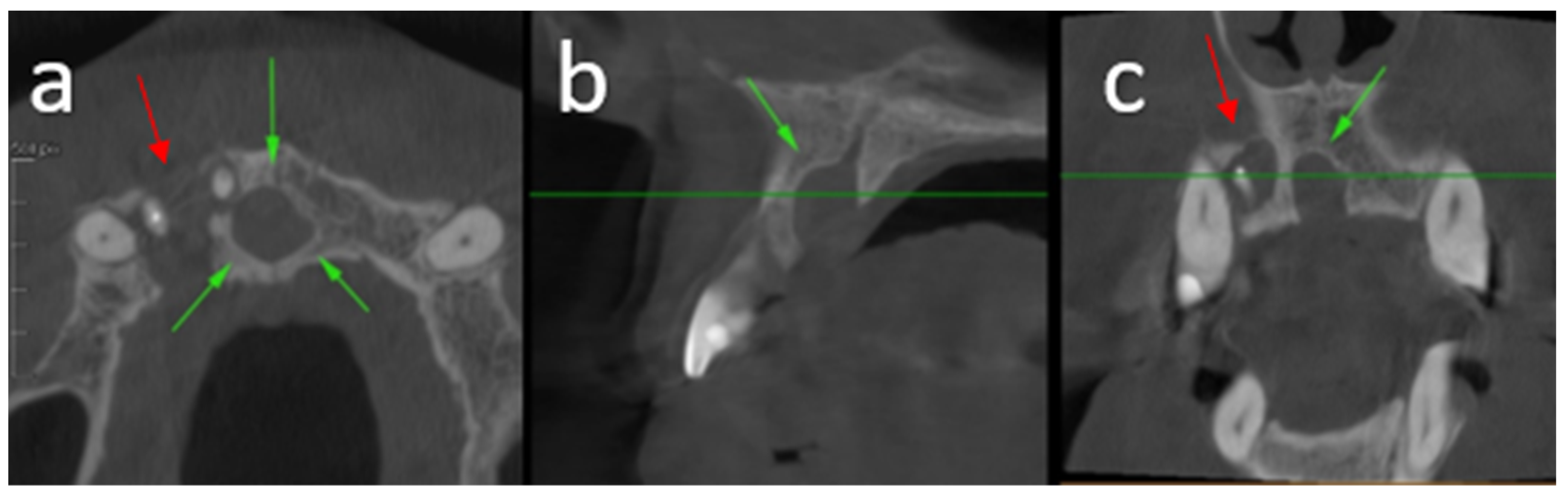 Oral 06 00085 g005 Oral 06 00085 g005