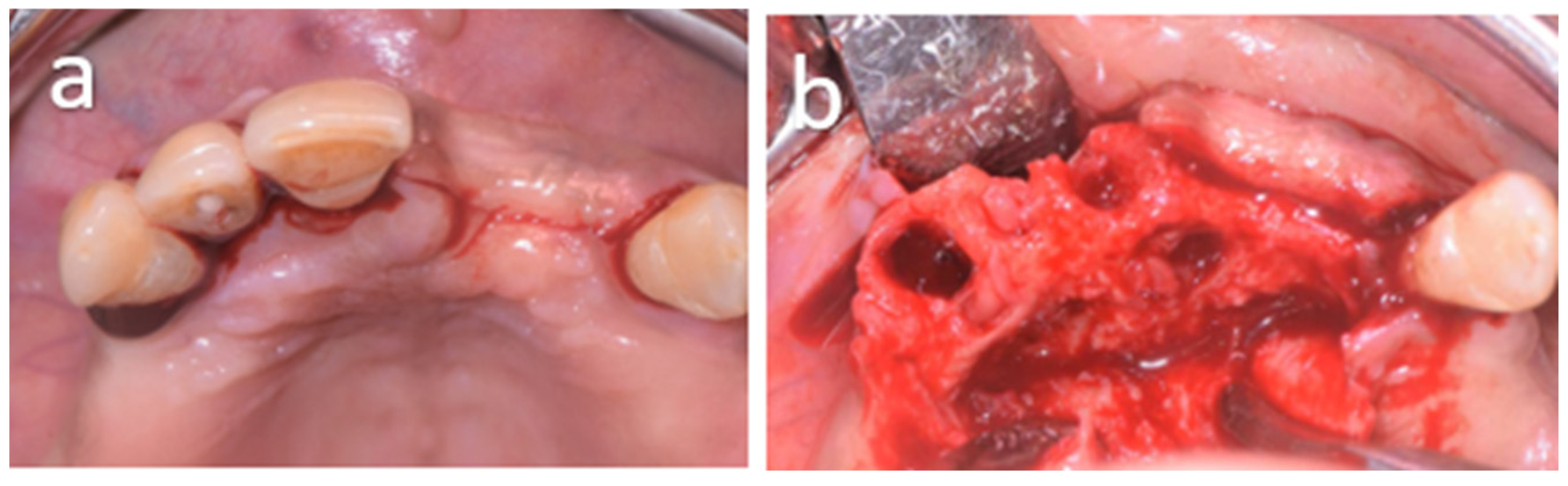 Oral 06 00085 g006 Oral 06 00085 g006