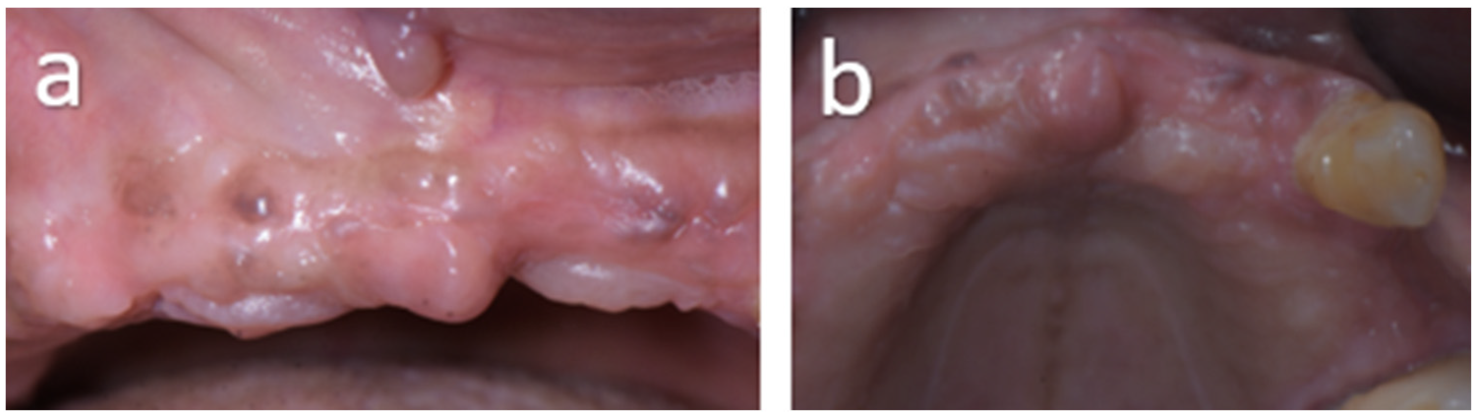 Oral 06 00085 g011 Oral 06 00085 g011