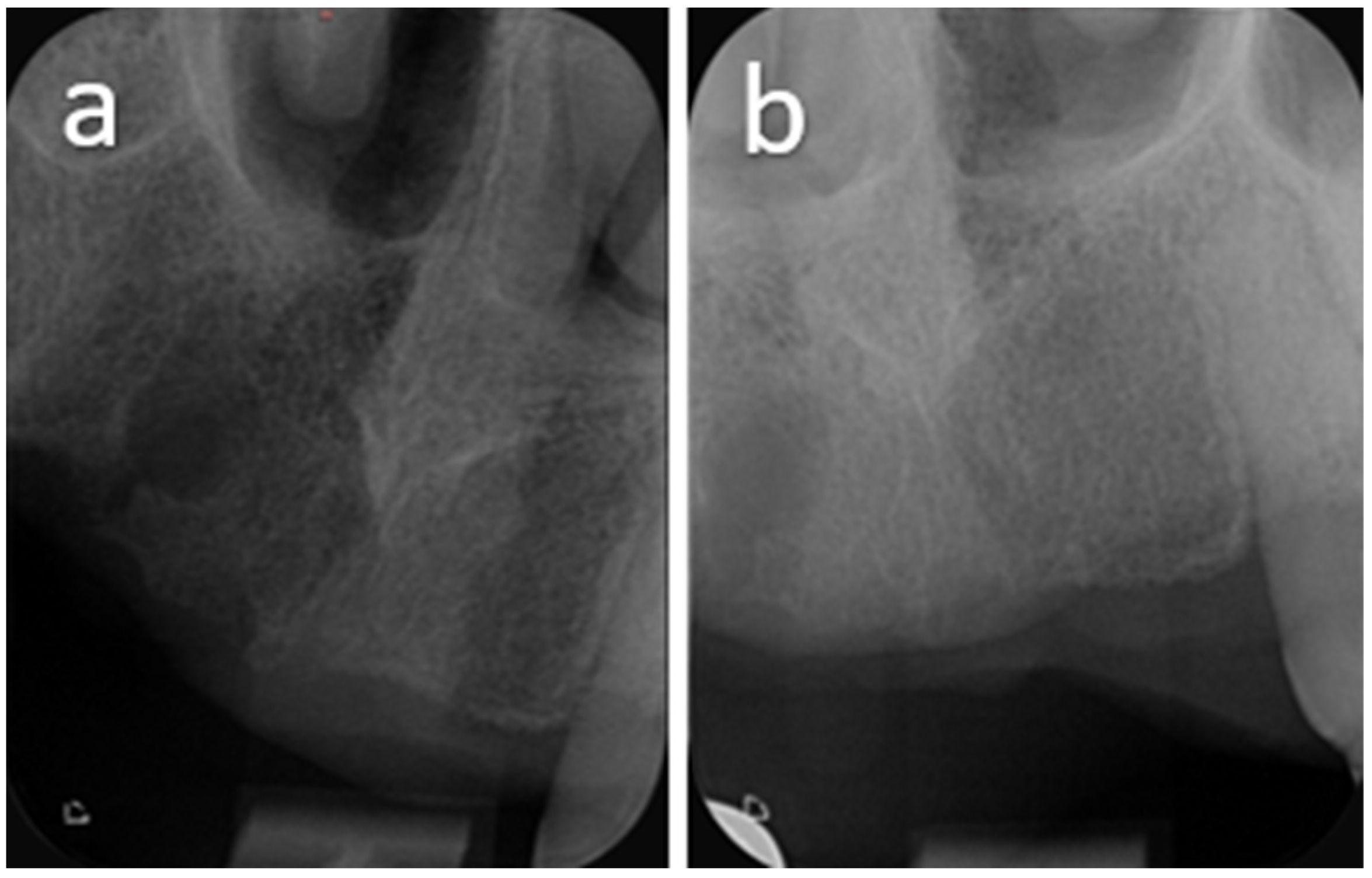 Oral 06 00085 g012 Oral 06 00085 g012