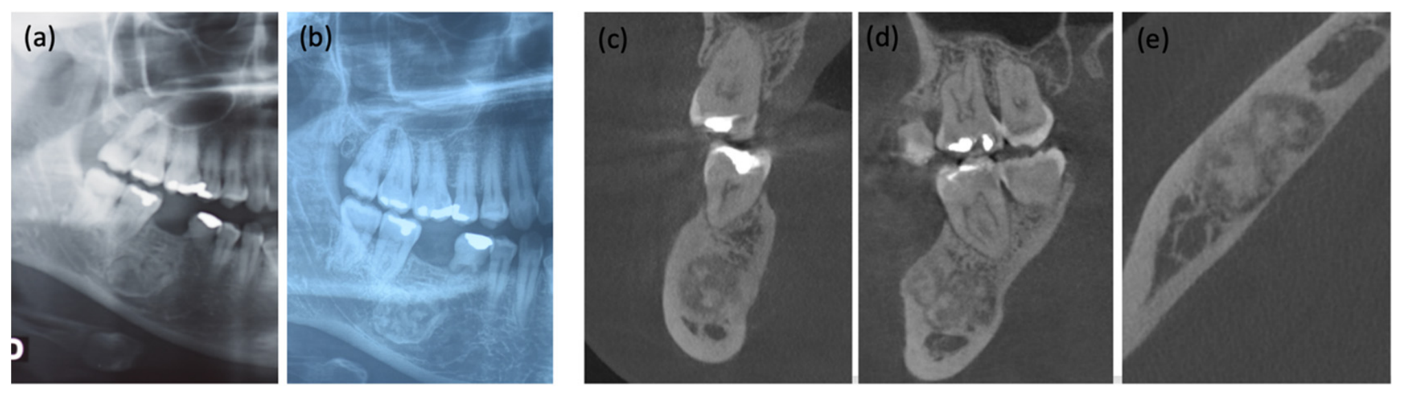 Oral 06 00136 g001 Oral 06 00136 g001