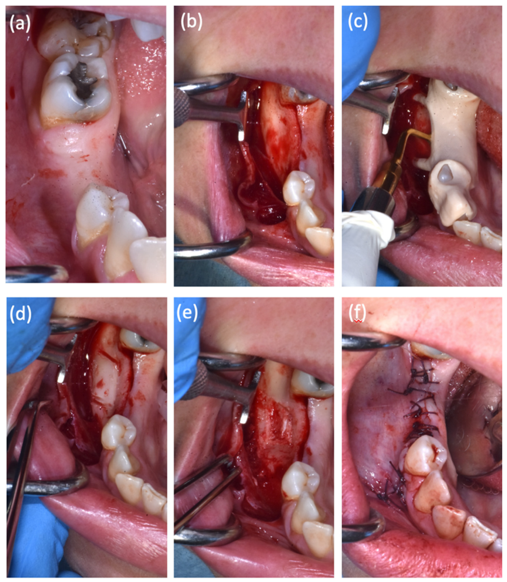 Oral 06 00136 g004 Oral 06 00136 g004
