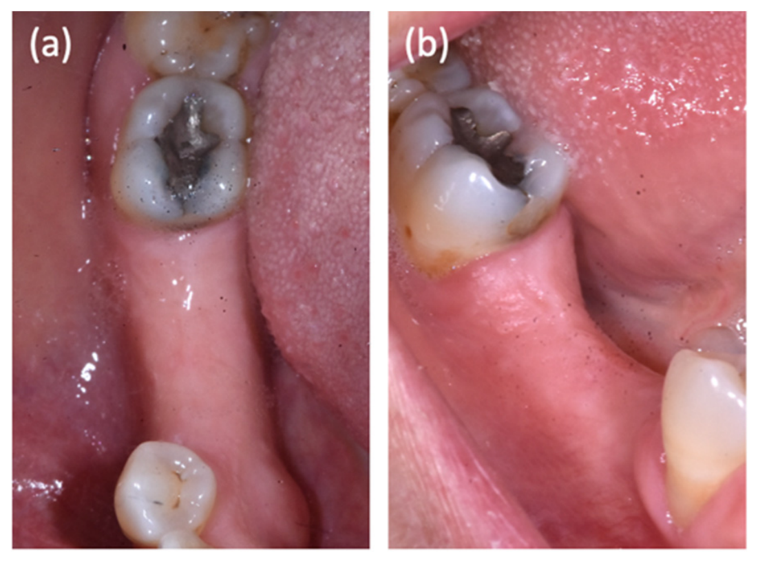 Oral 06 00136 g006 Oral 06 00136 g006