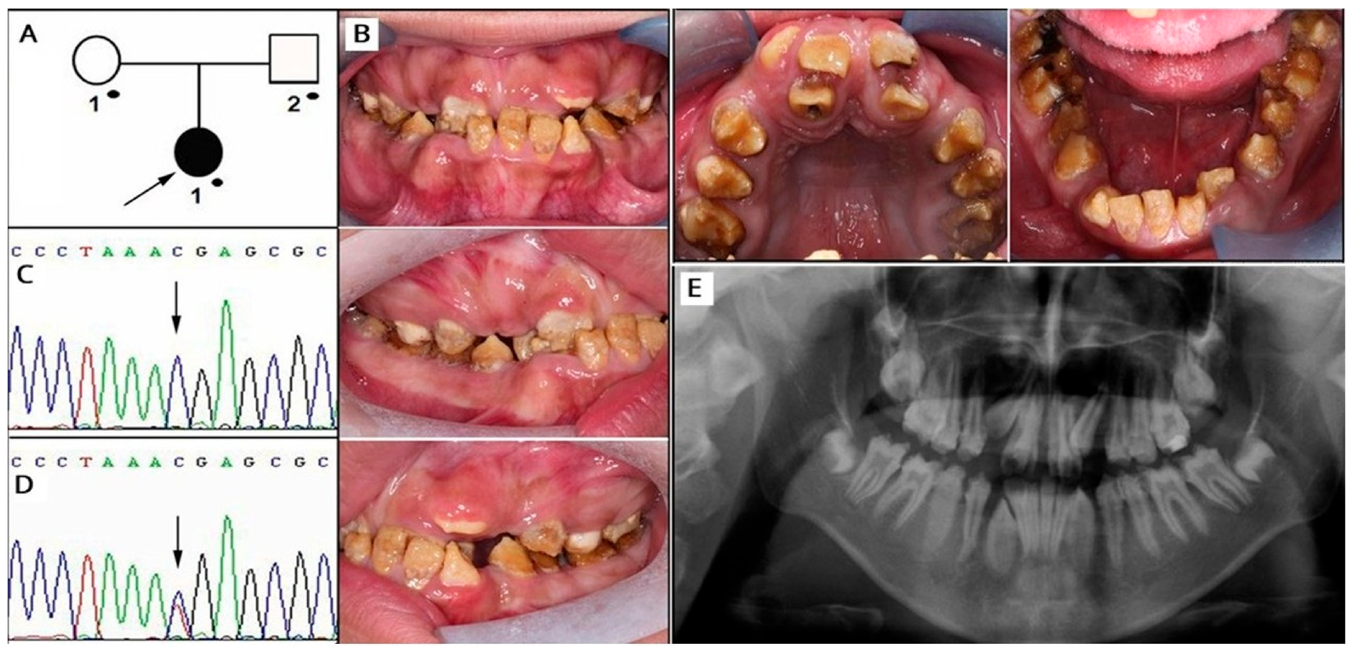 Oral 06 00139 g002 Oral 06 00139 g002