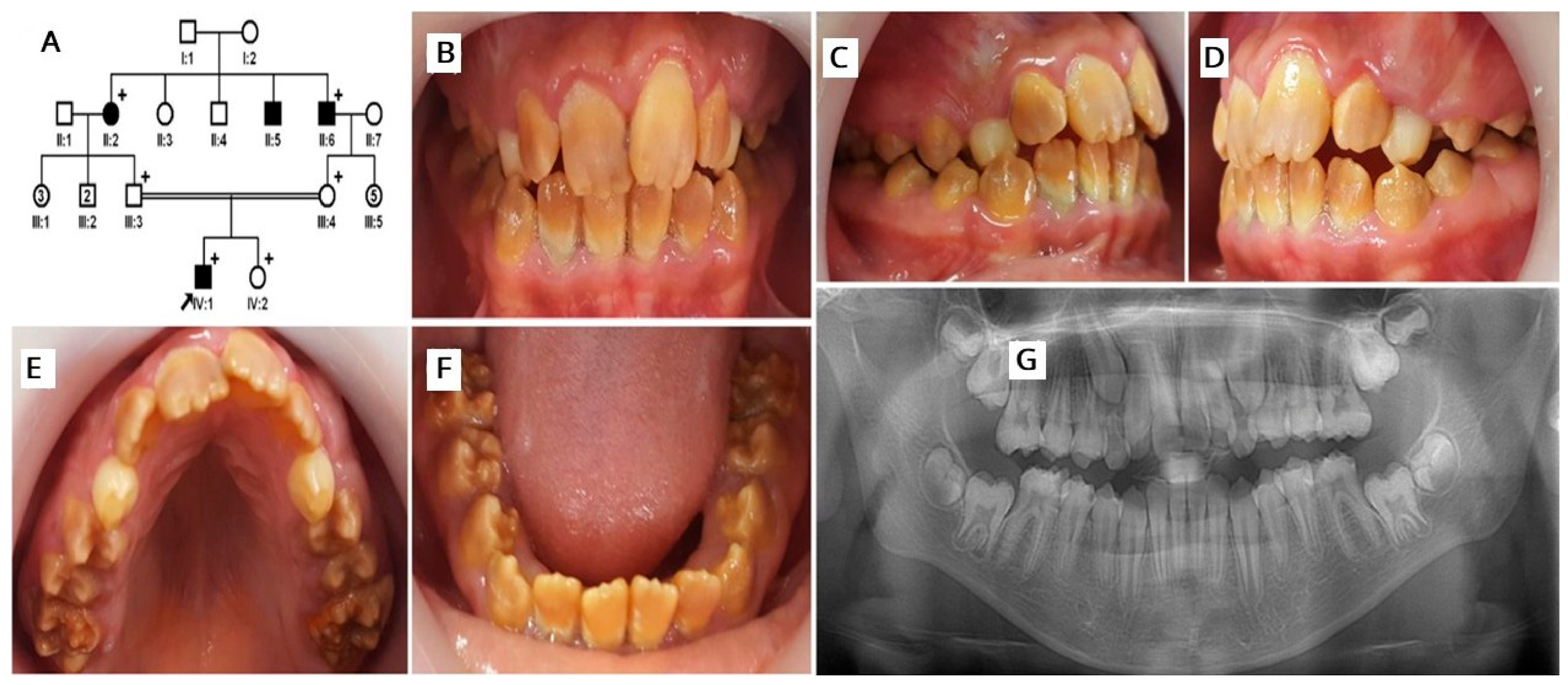 Oral 06 00139 g003 Oral 06 00139 g003