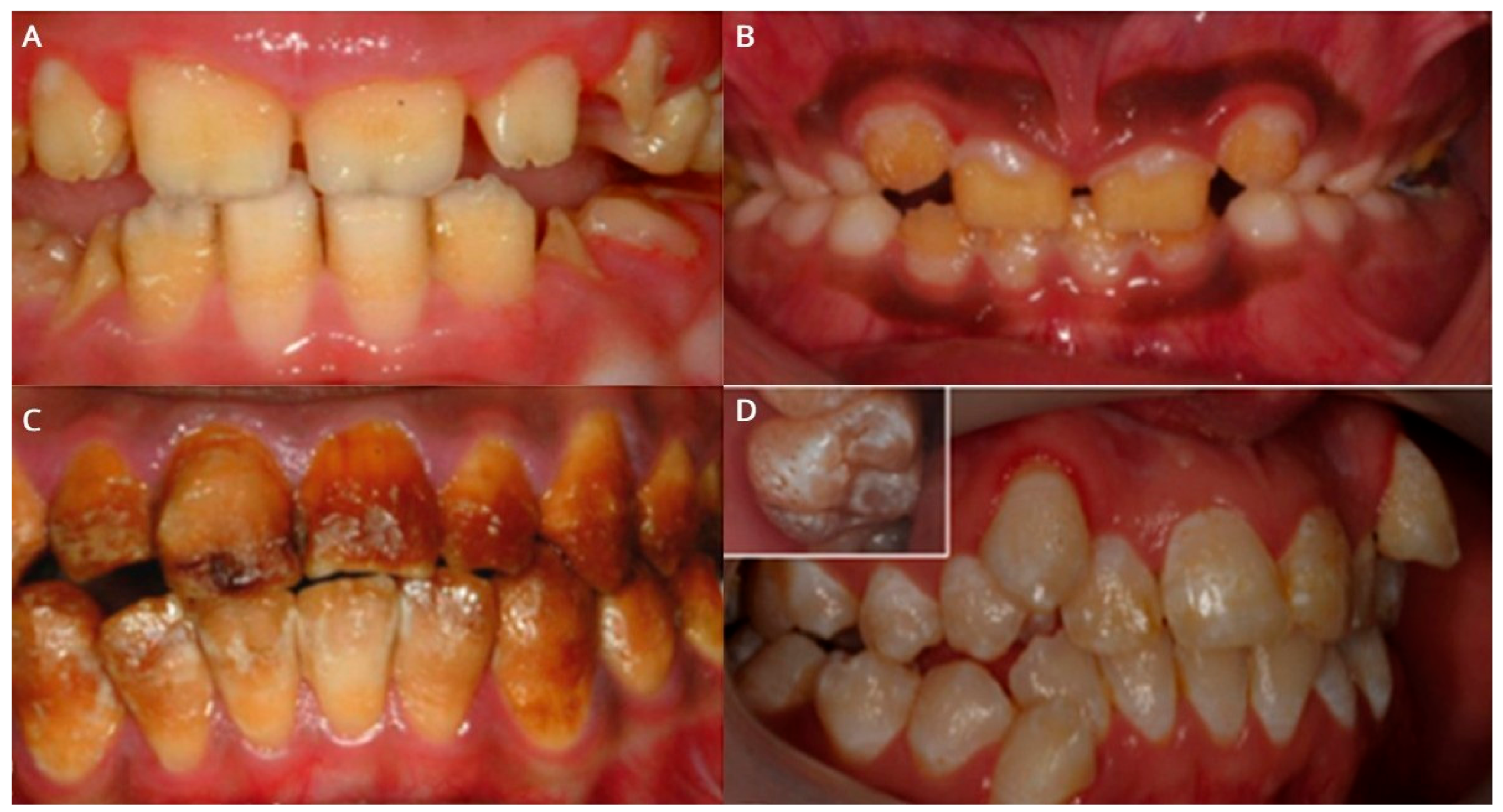 Oral 06 00139 g004 Oral 06 00139 g004