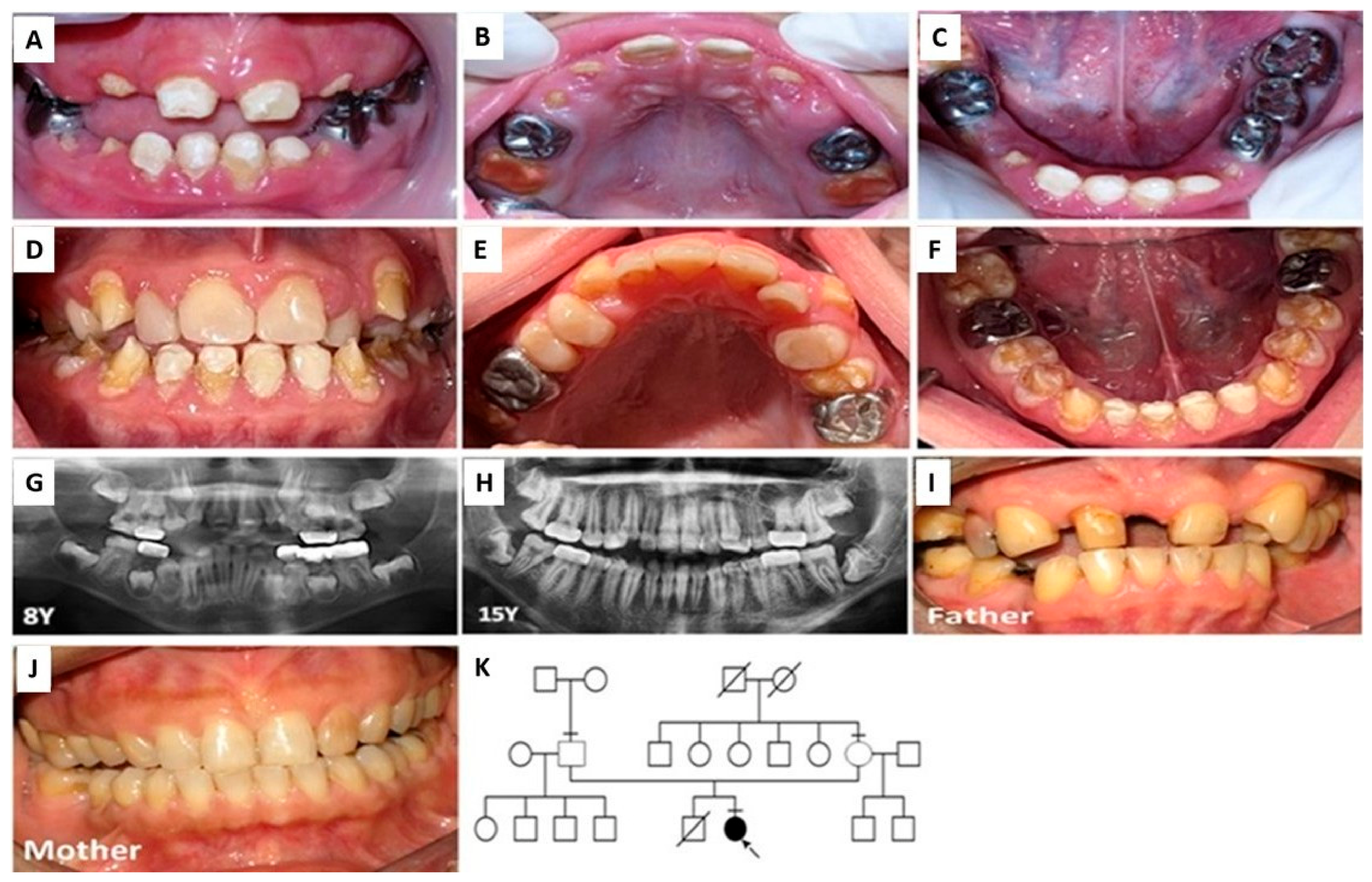 Oral 06 00139 g005 Oral 06 00139 g005
