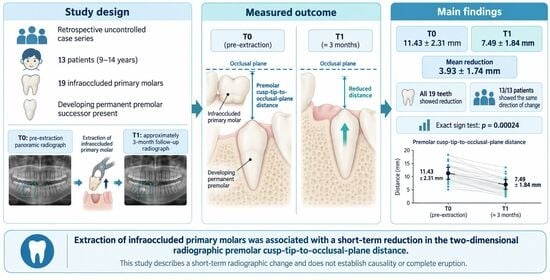 Extraction procedure for an infraoccluded upper primary molar: (a) access flap design; (b) full-thickness flap elevation; (c) odontotomy; (d) residual alveolus; (e) suture; (f) extracted tooth.