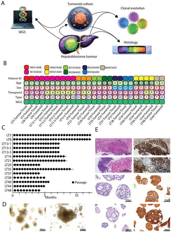 (A) schematic overview of biobanking process. (B). Sample overview with patient identifier and metadata (age, sex, and time of procurement). P indicates primary sample usually at time of diagnosis, R indicates samples from resection or recurrence. Tumour samples are marked T, and tumoroid samples are marked O. Sex is shown by M(ale) or F(emale), and age in years. WGS data is shown in green. (C). Graph showing the time in culture and number of passages for each tumoroid line. (D). Representative brightfield images of hepatoblastoma tumoroid cultures. (E). H&E stain (left) and β-catenin stain (right) of tumour tissue (top panels) and tumoroid lines (bottom panels).
