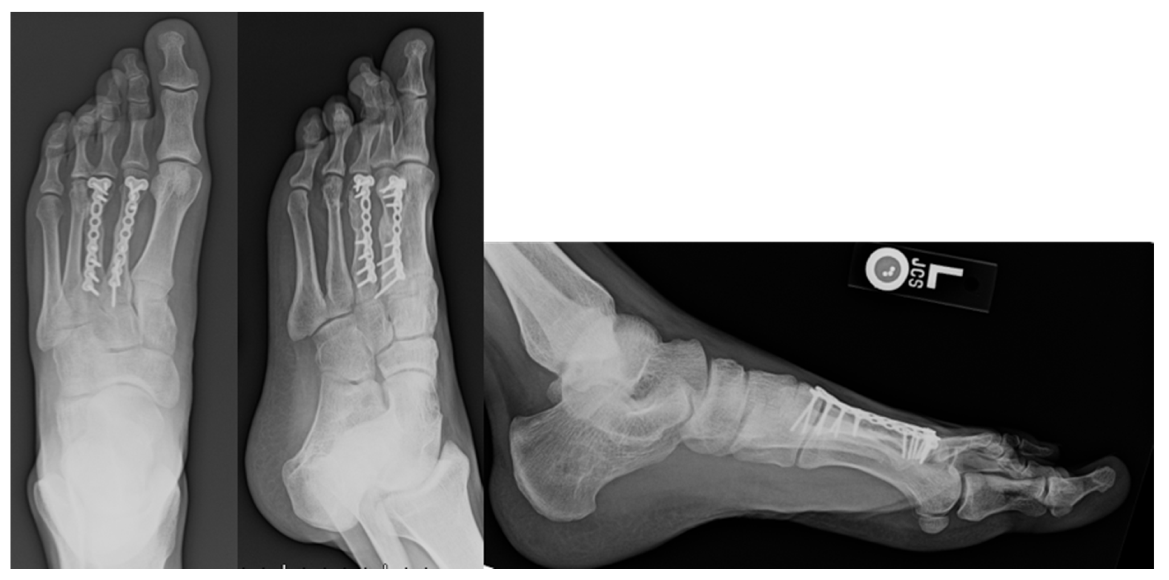 Osteology 02 00009 g002