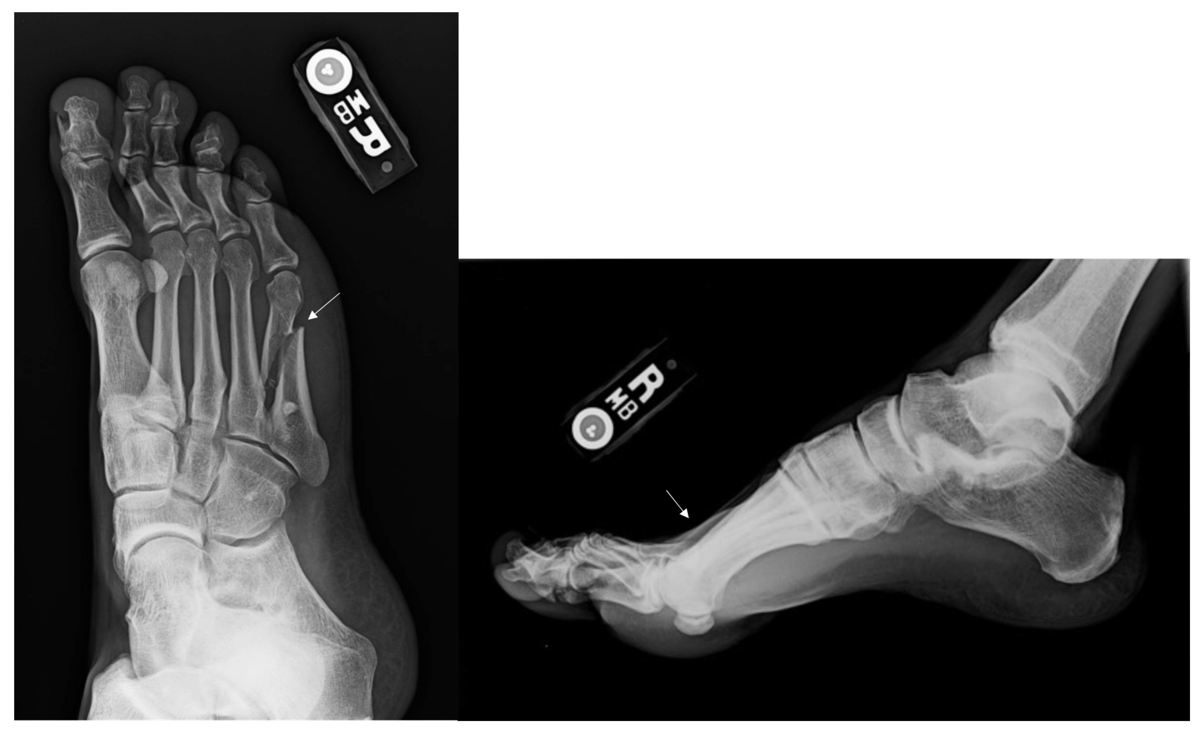 Osteology 02 00009 g004