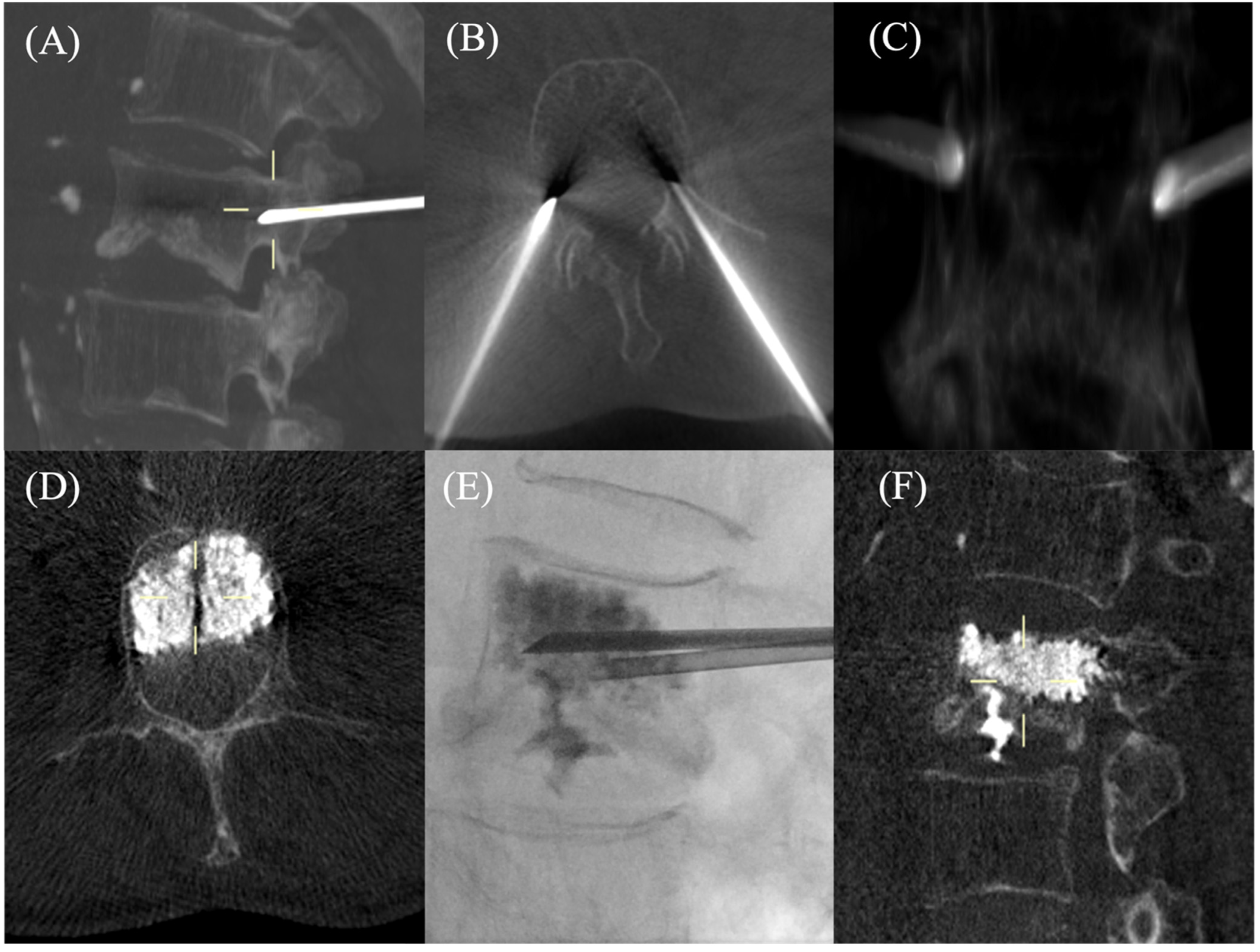 Osteology 02 00017 g002
