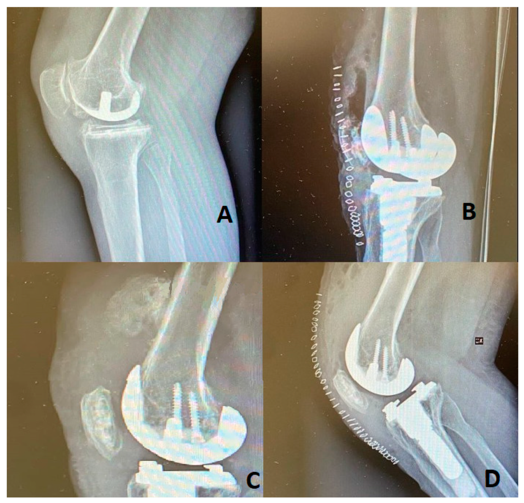 Osteology 02 00019 g001