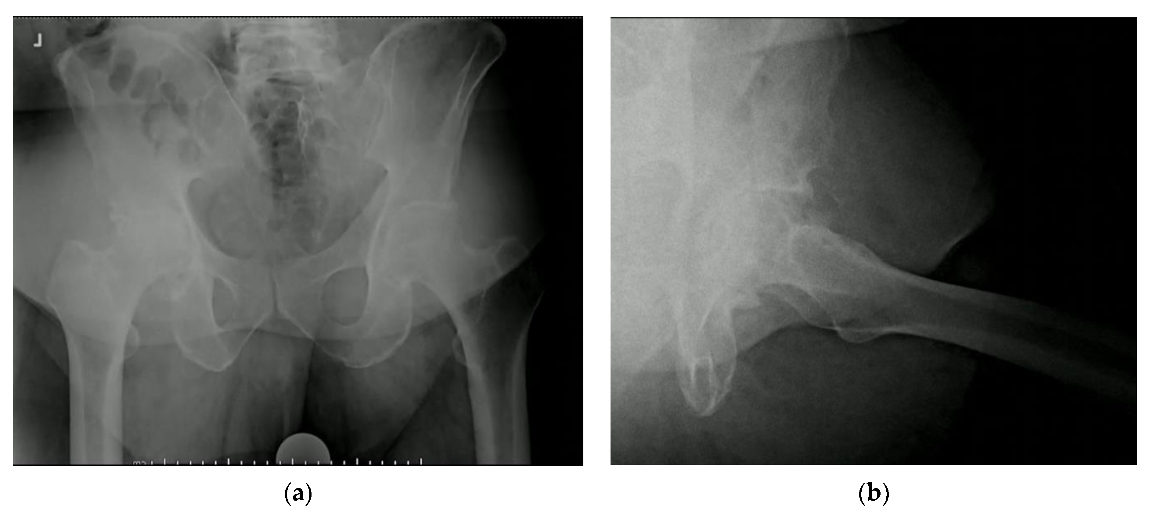 Osteology 03 00005 g002 Osteology 03 00005 g002