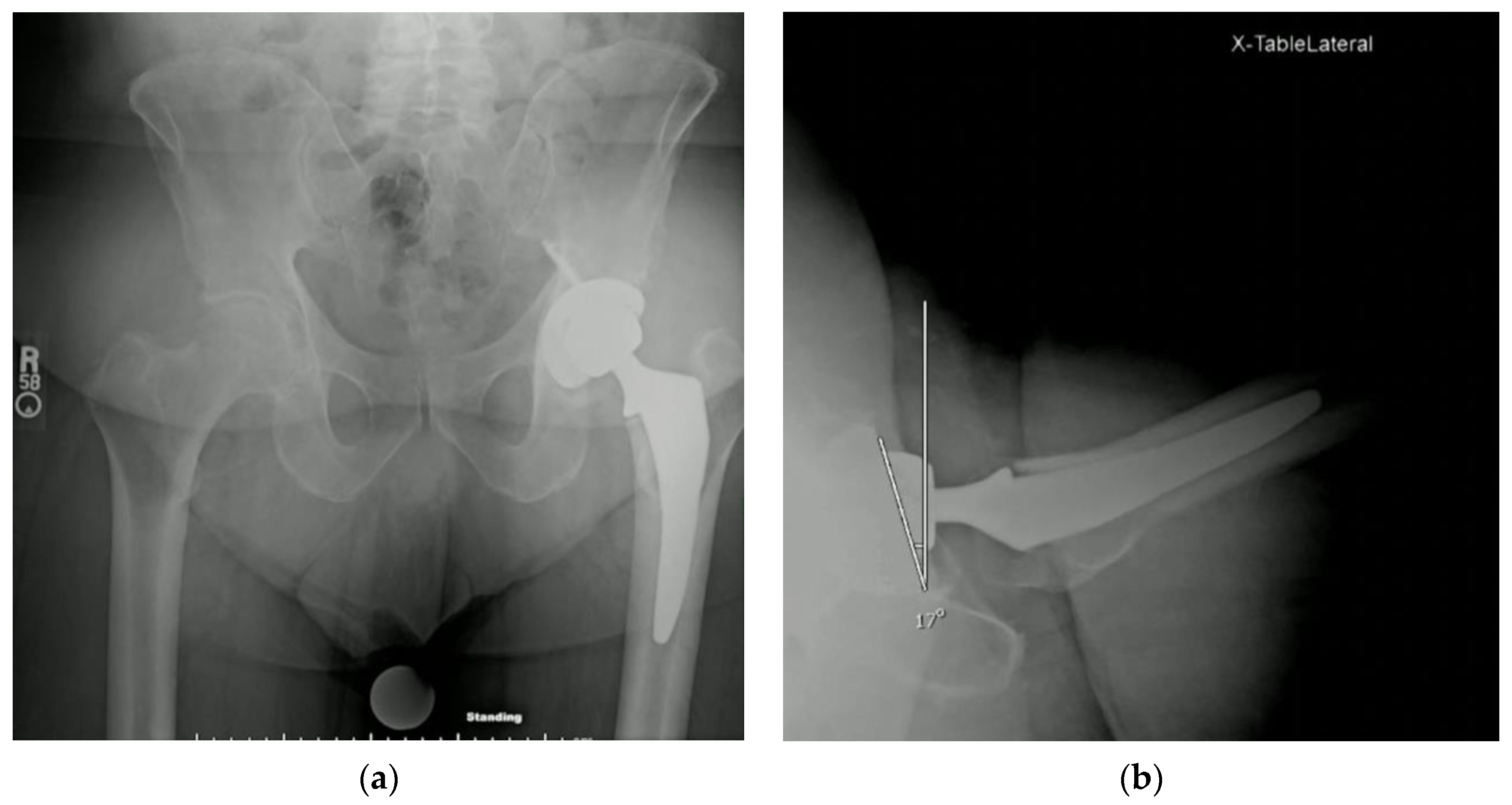 Osteology 03 00005 g004 Osteology 03 00005 g004