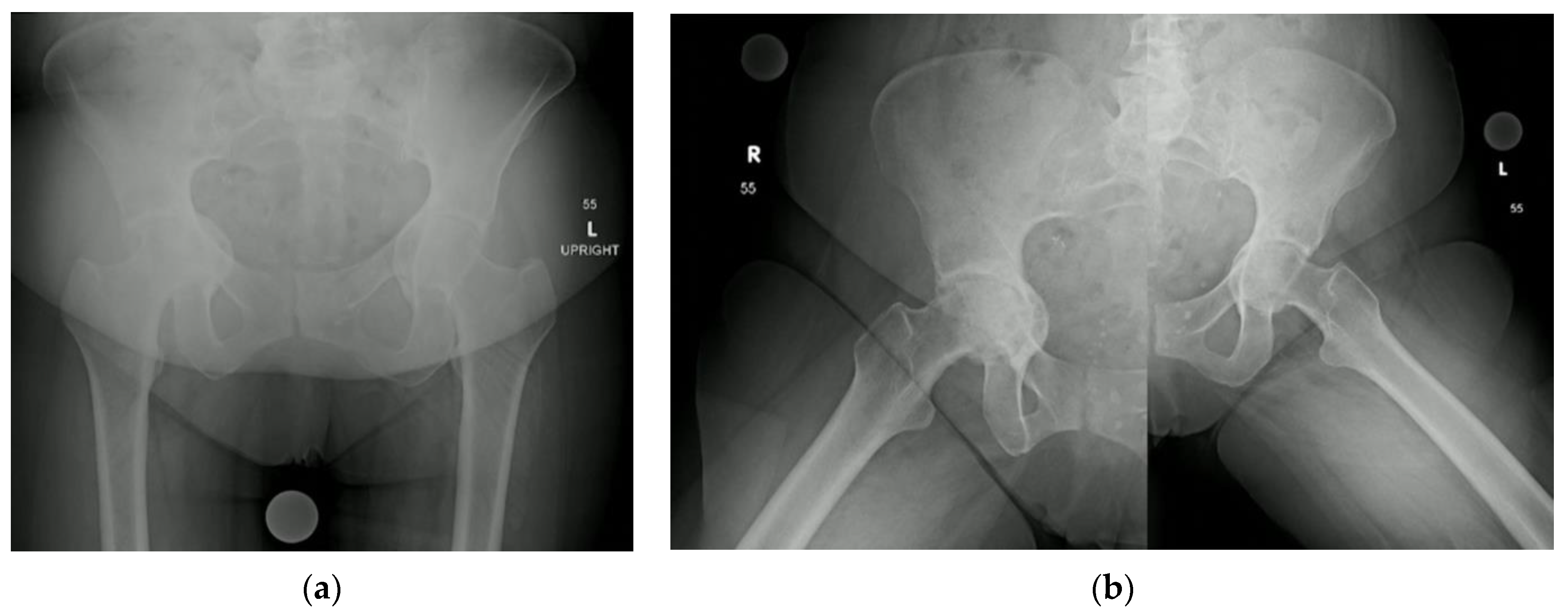 Osteology 03 00005 g005 Osteology 03 00005 g005