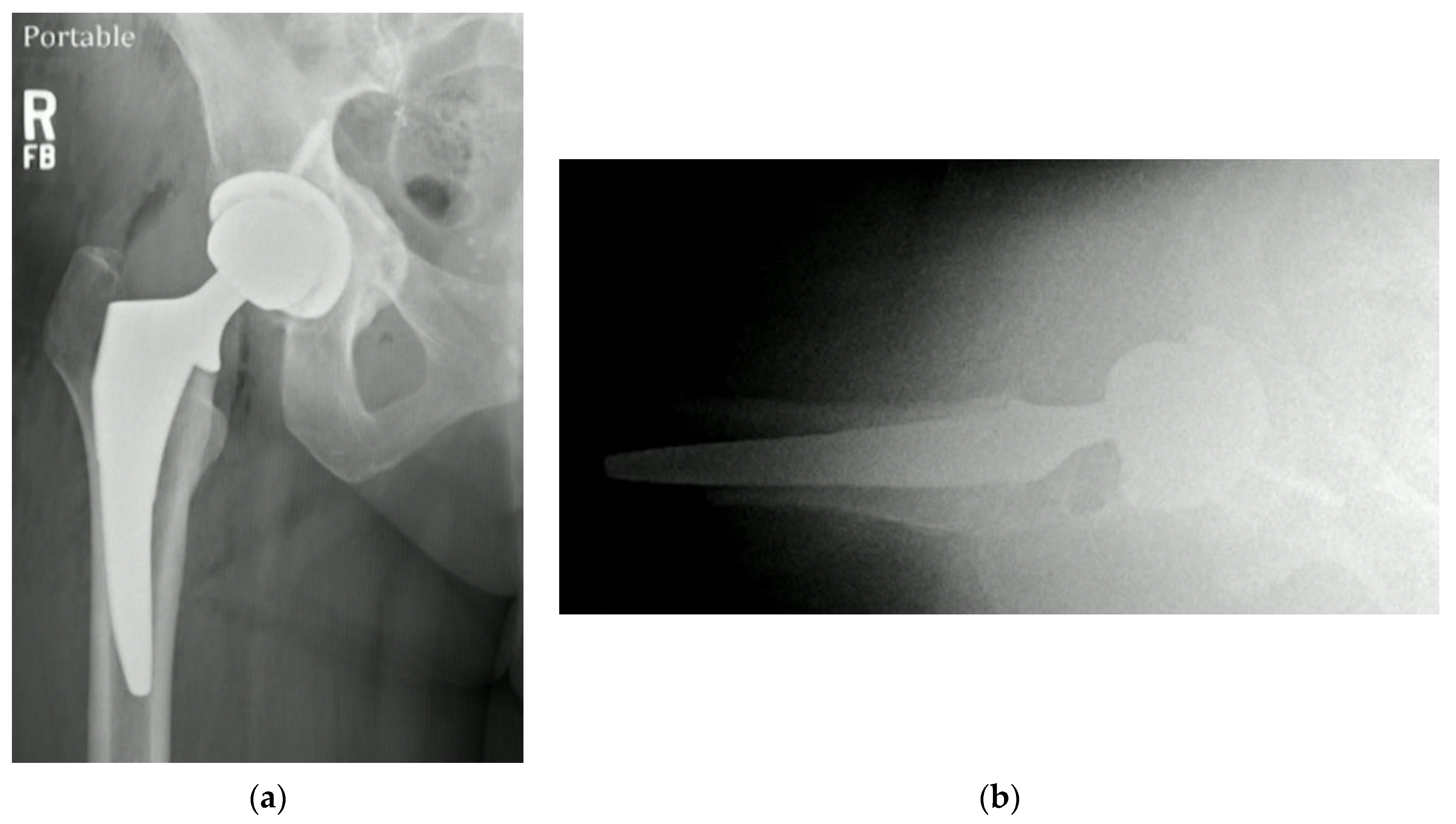 Osteology 03 00005 g007 Osteology 03 00005 g007