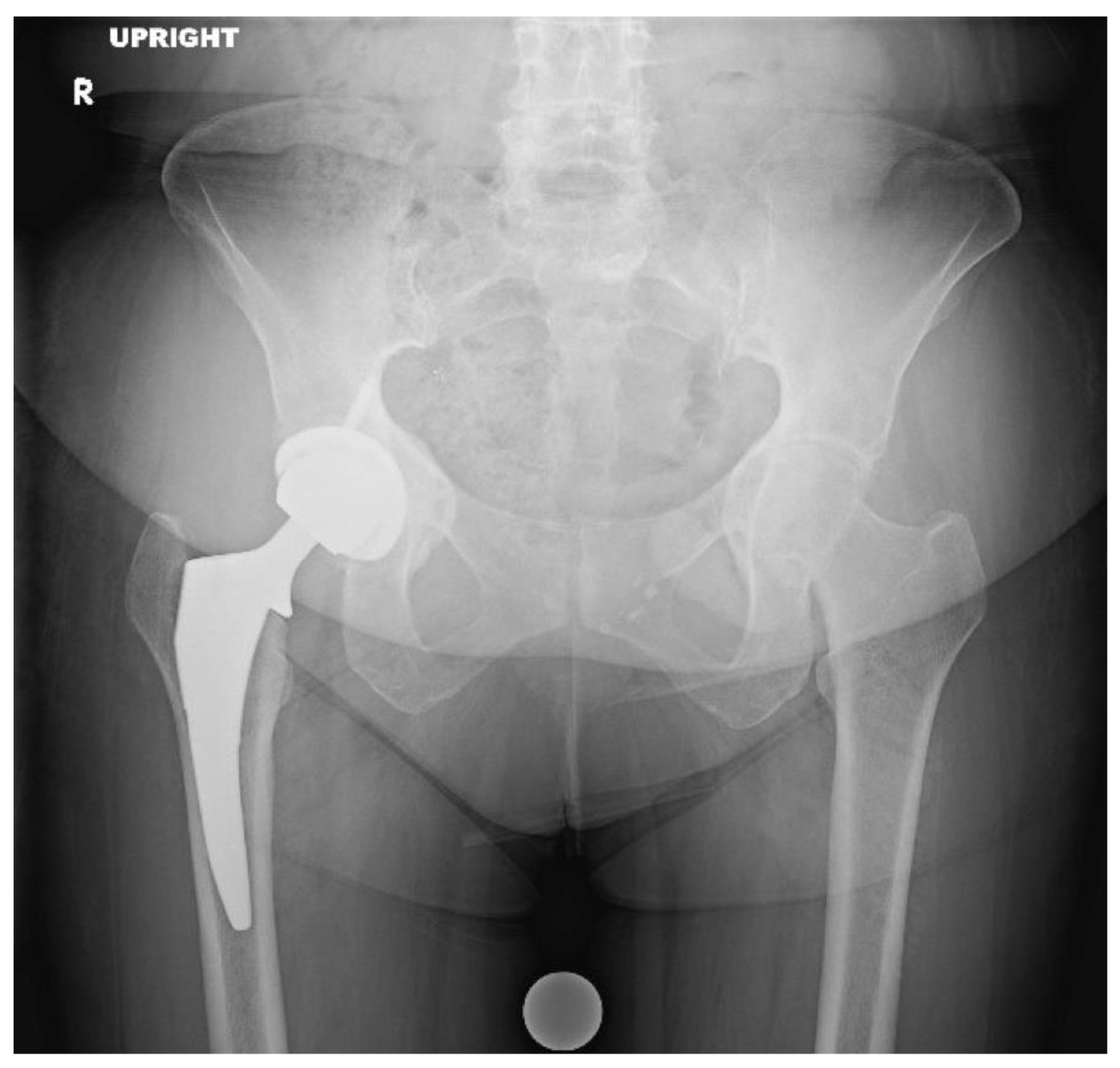 Osteology 03 00005 g008 Osteology 03 00005 g008