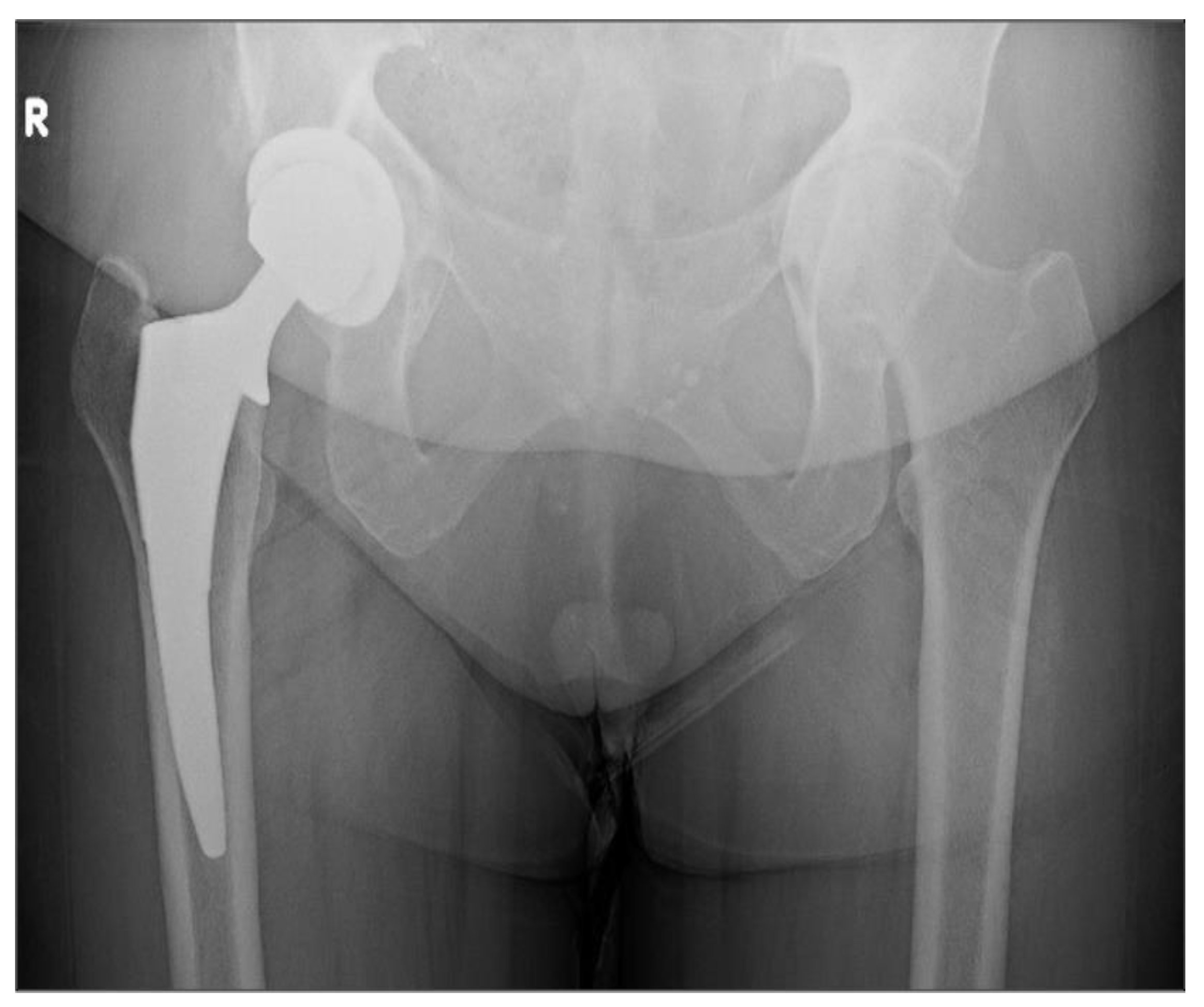 Osteology 03 00005 g009 Osteology 03 00005 g009