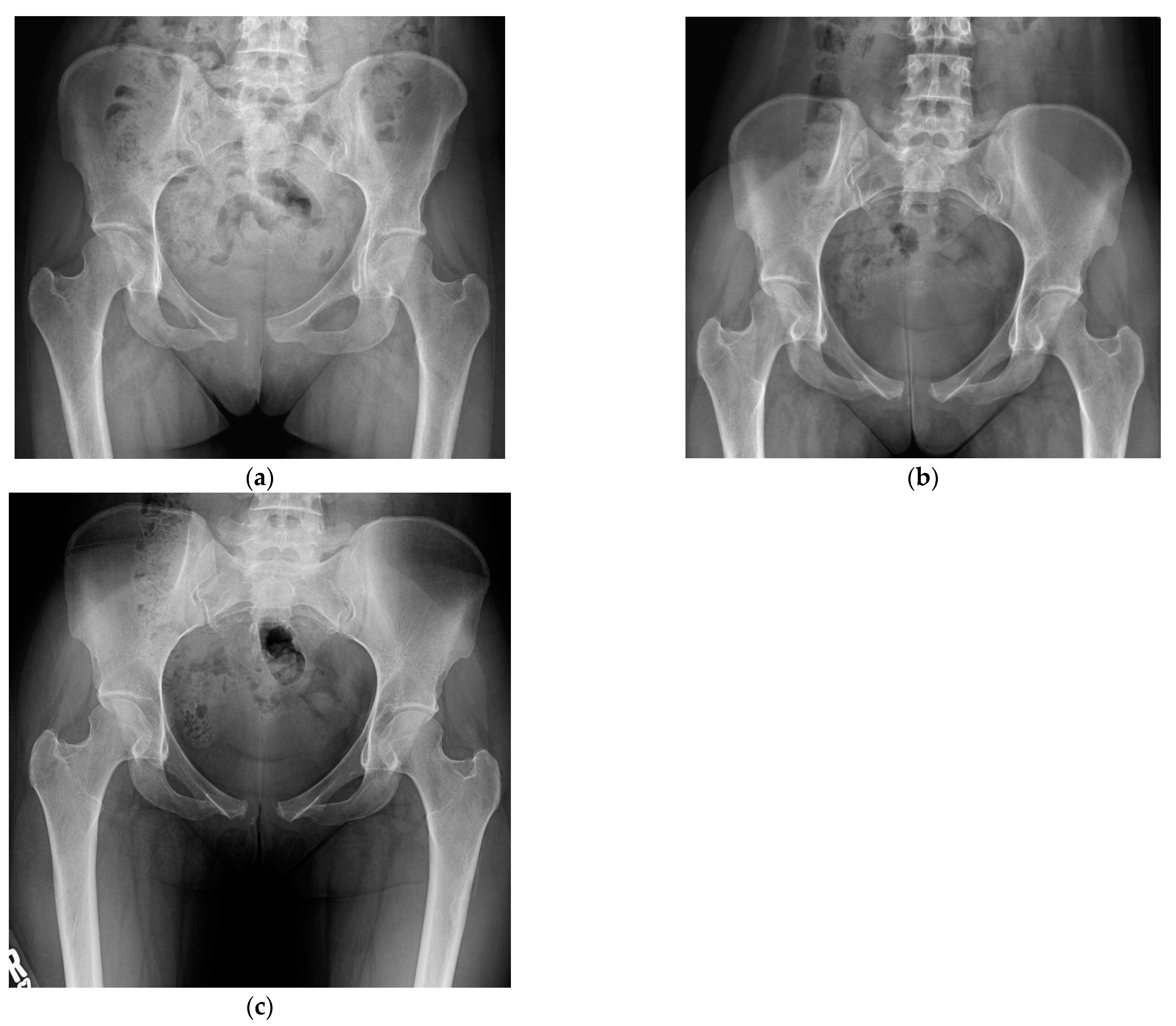 Osteology 03 00012 g003