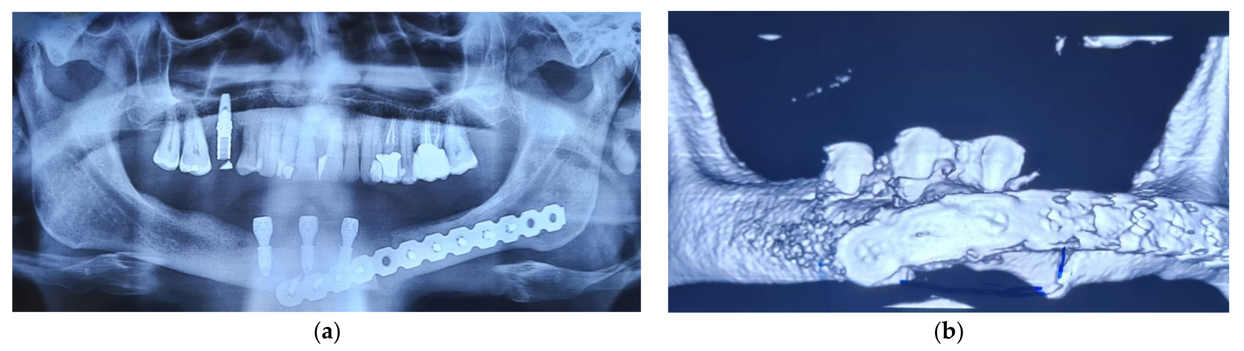 Osteology 04 00001 g007 Osteology 04 00001 g007