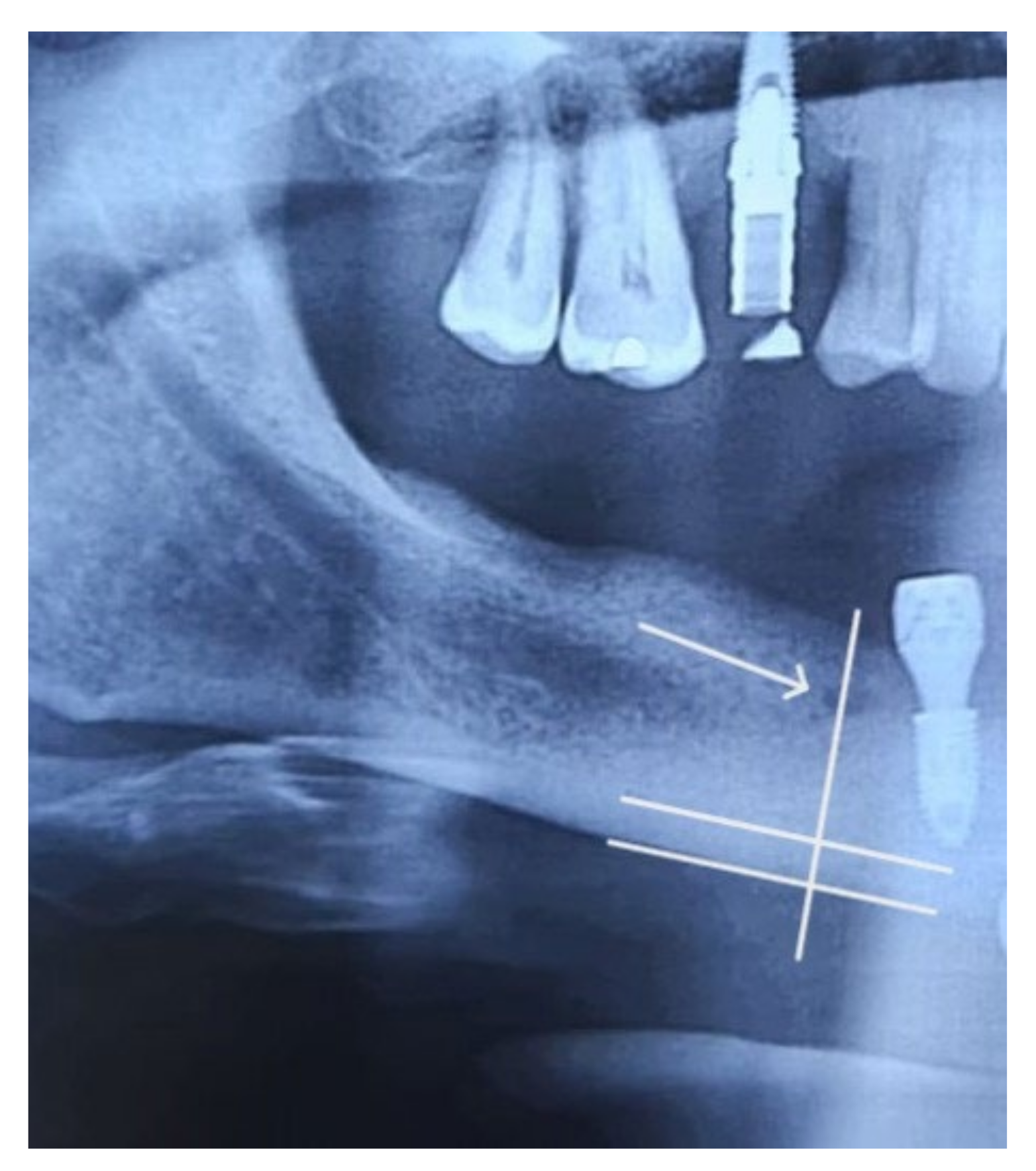 Osteology 04 00001 g008 Osteology 04 00001 g008