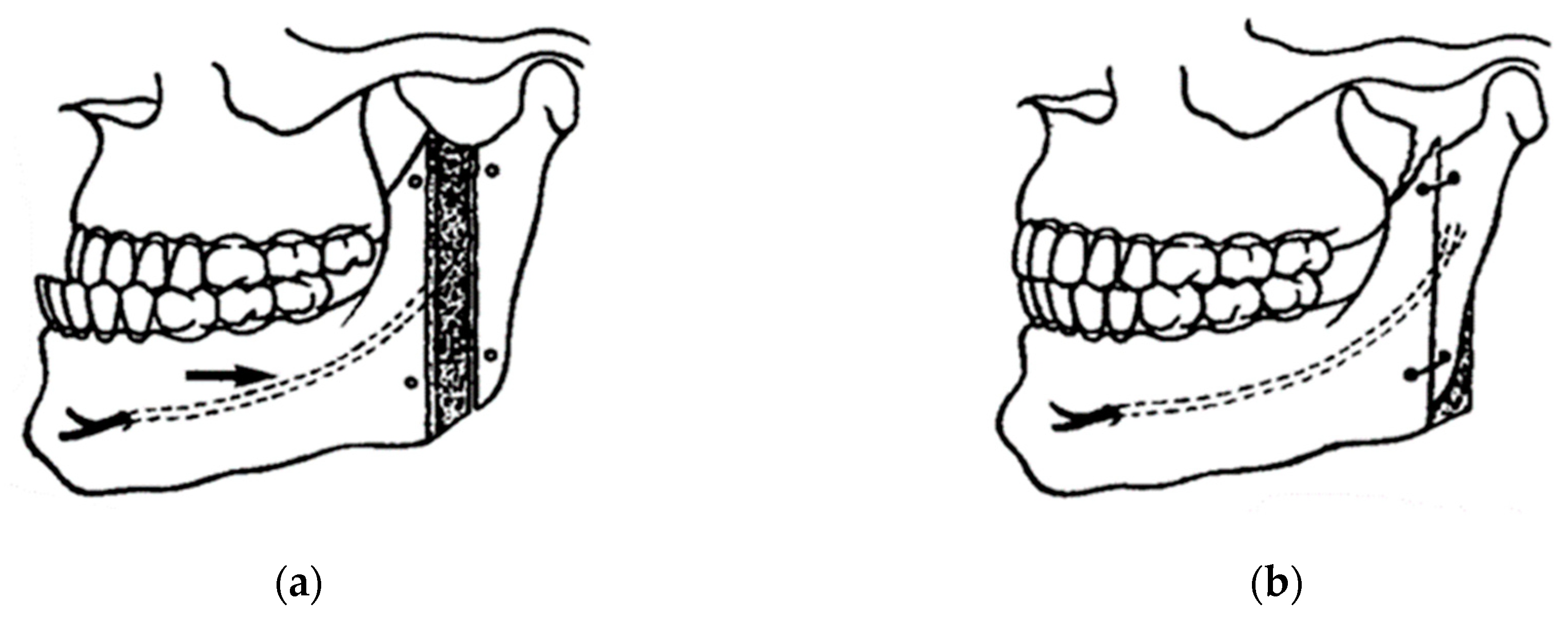 Osteology 04 00002 g004