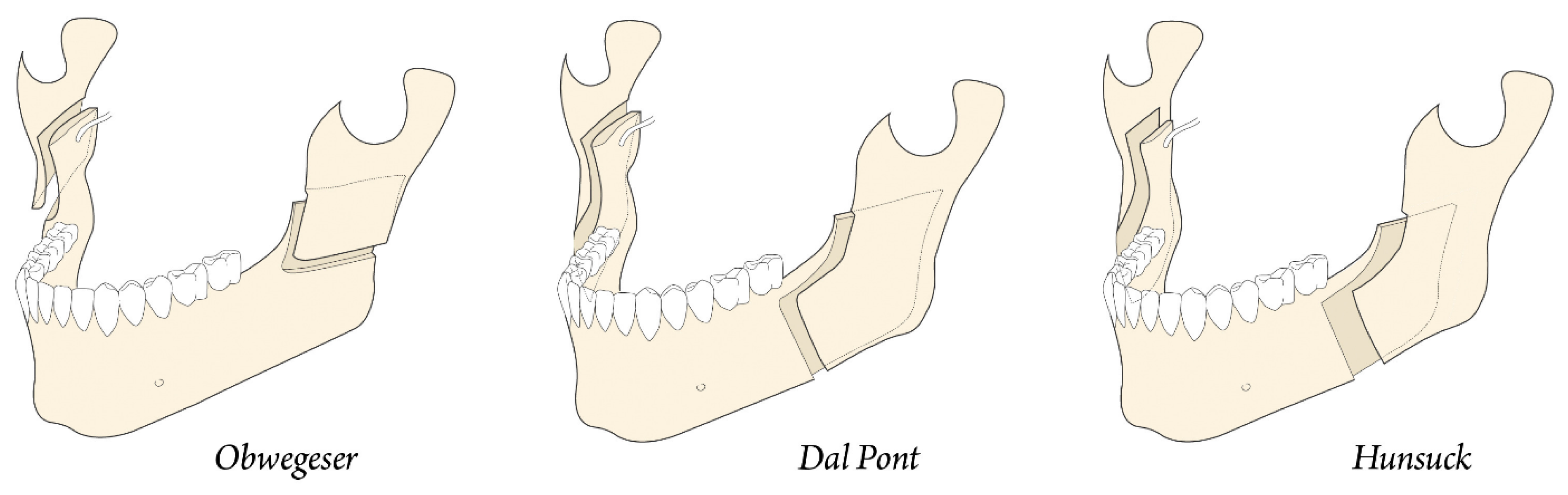 Osteology 04 00002 g006