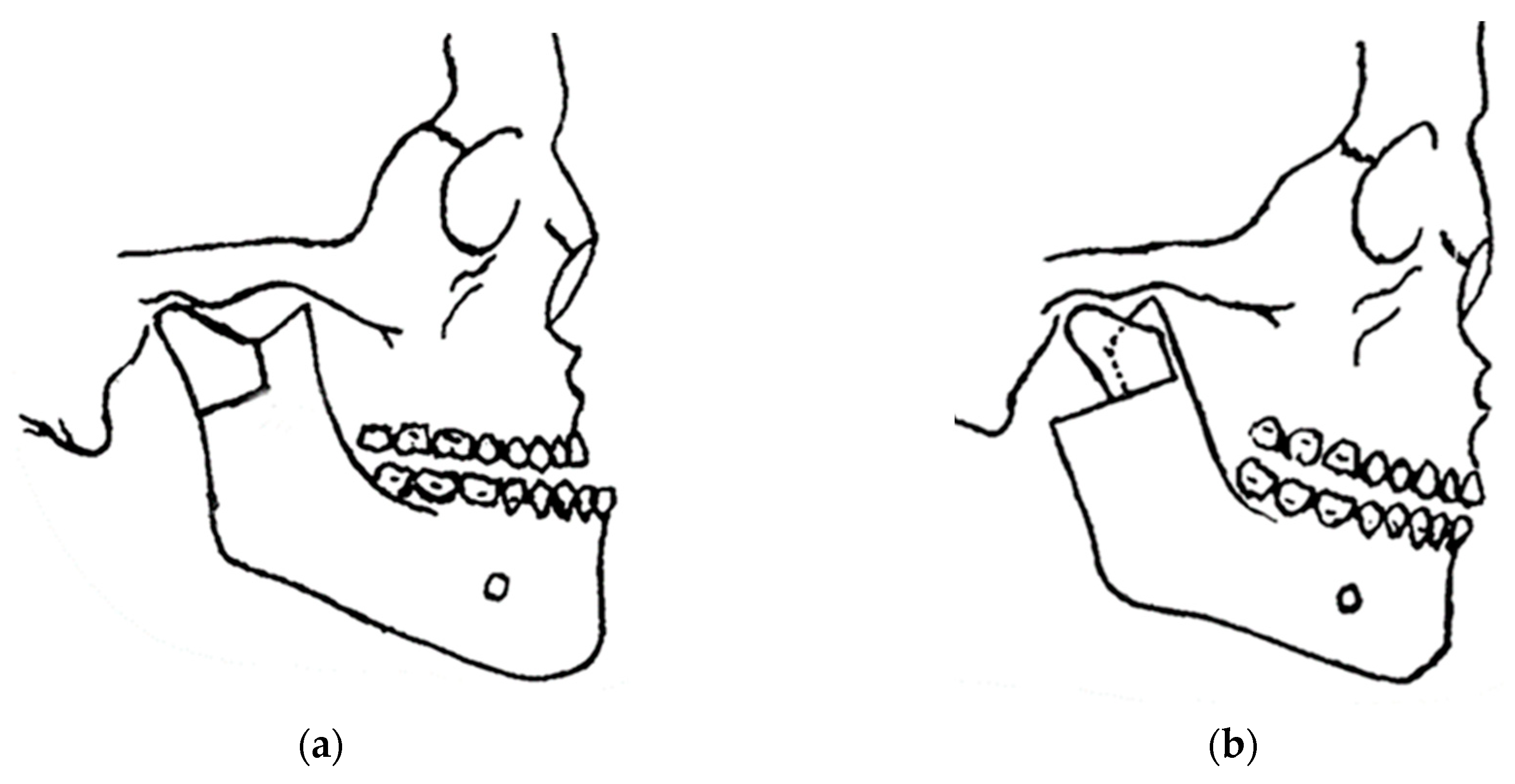 Osteology 04 00002 g008