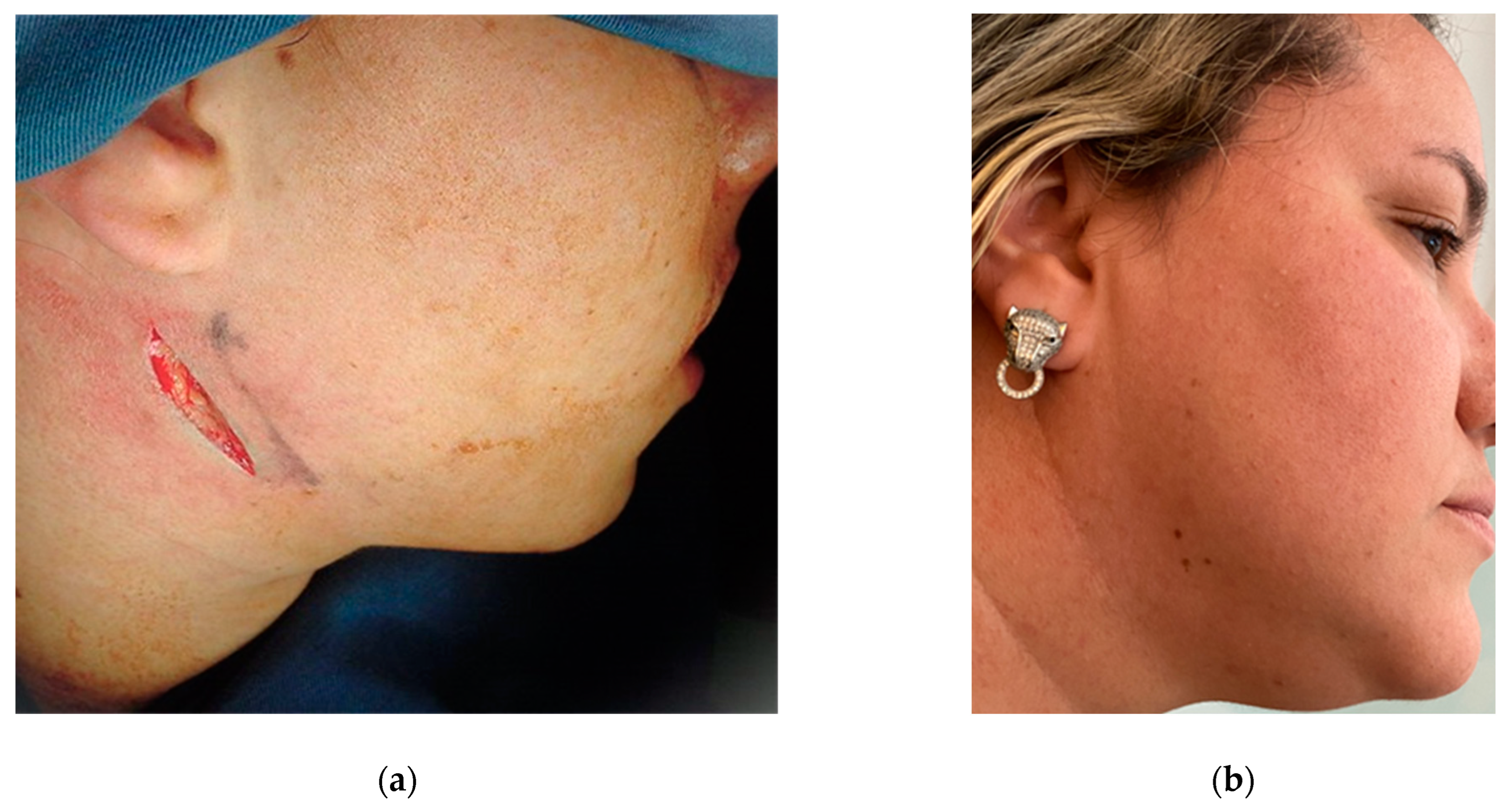 Osteology 04 00002 g009