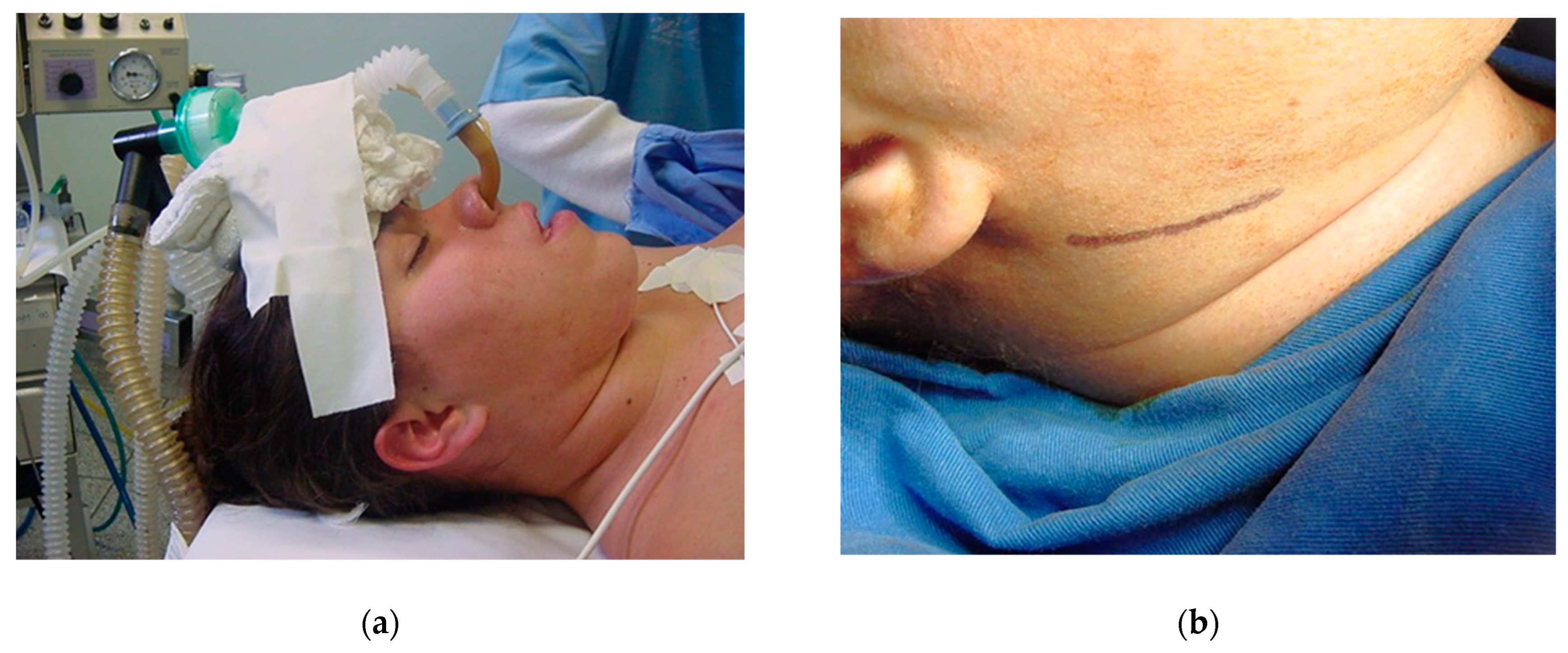 Osteology 04 00002 g011