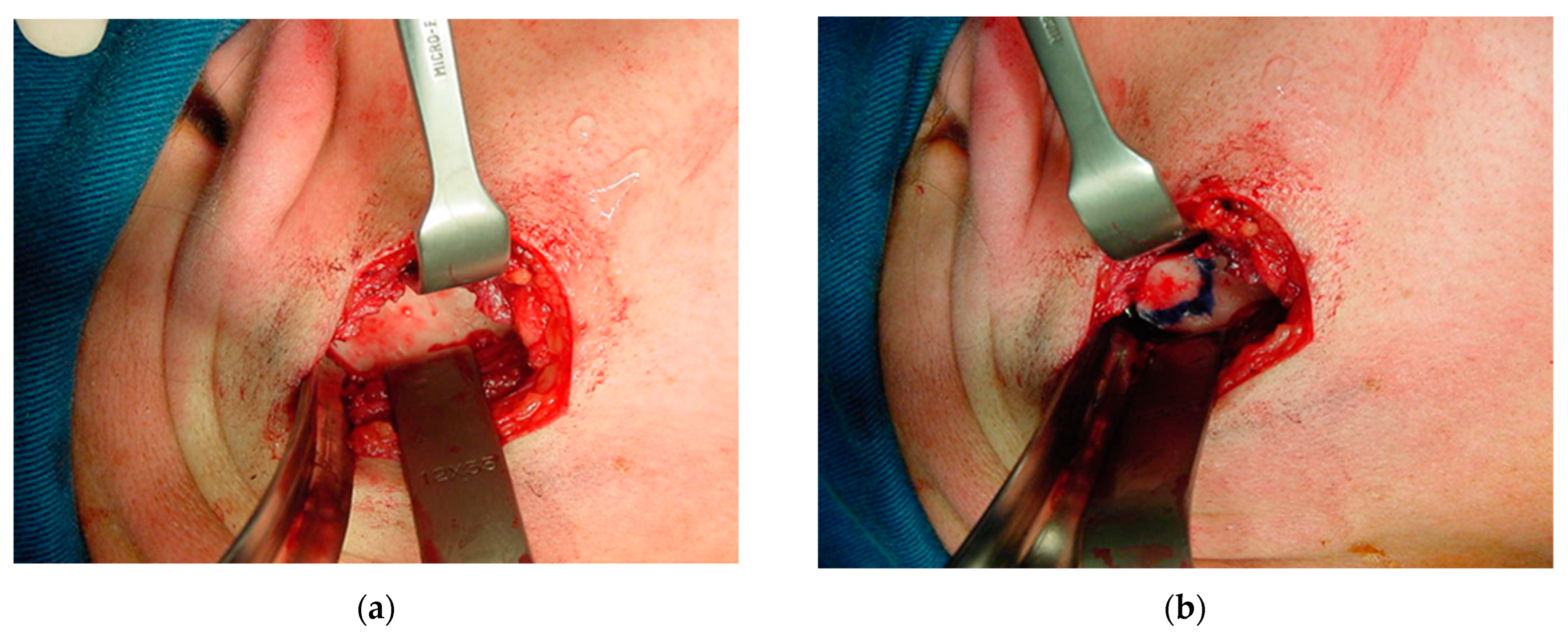 Osteology 04 00002 g012