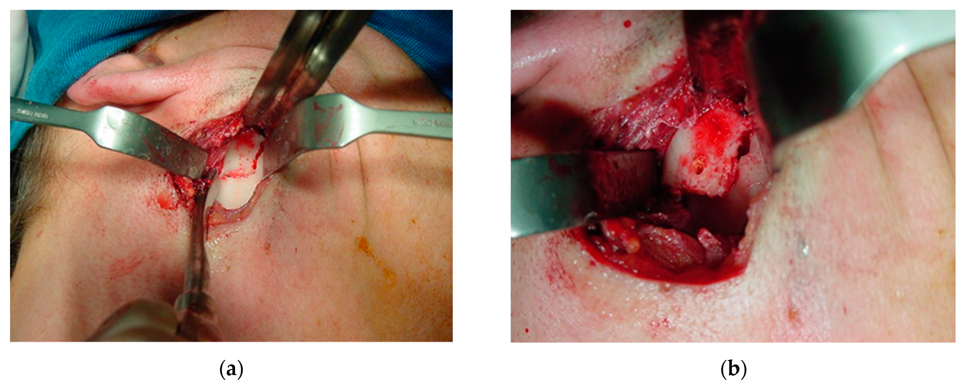 Osteology 04 00002 g013