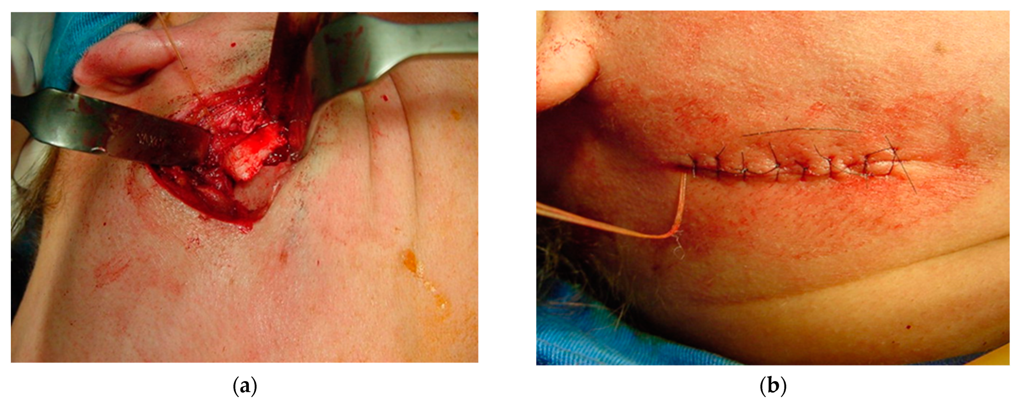 Osteology 04 00002 g014