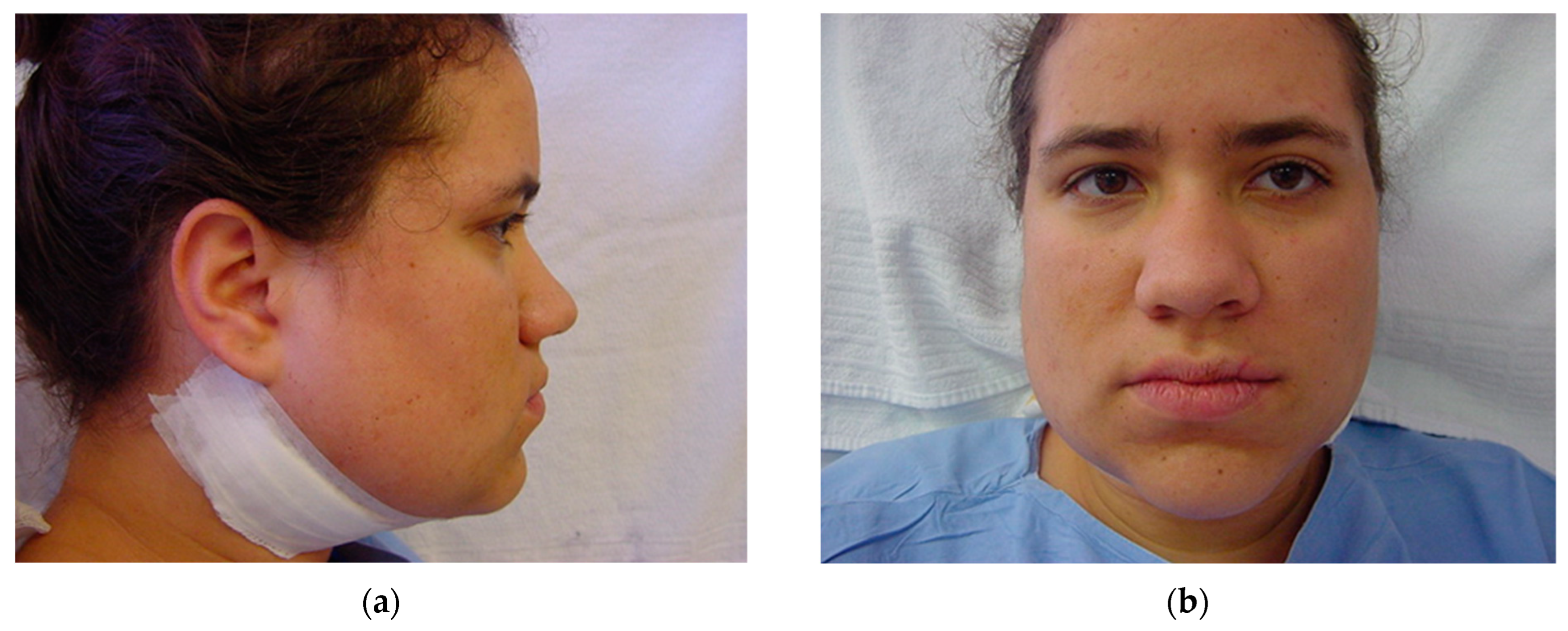 Osteology 04 00002 g015