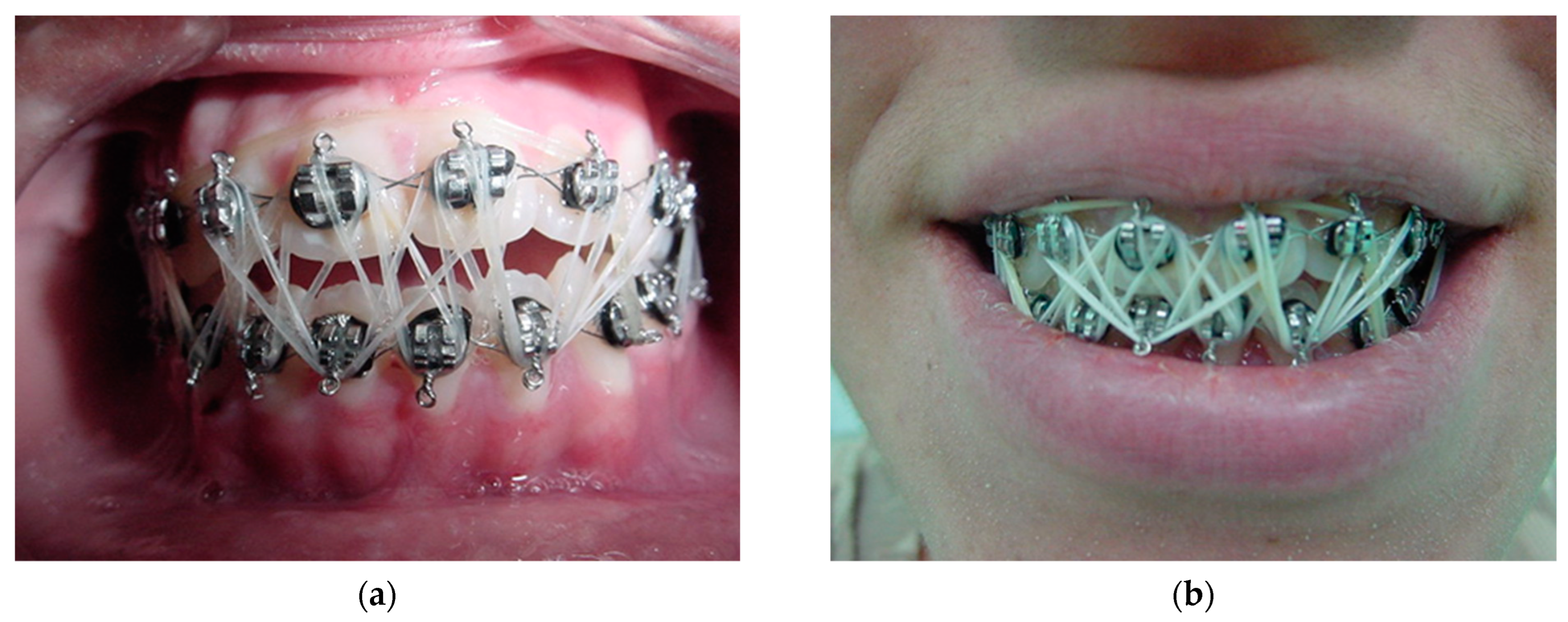 Osteology 04 00002 g016