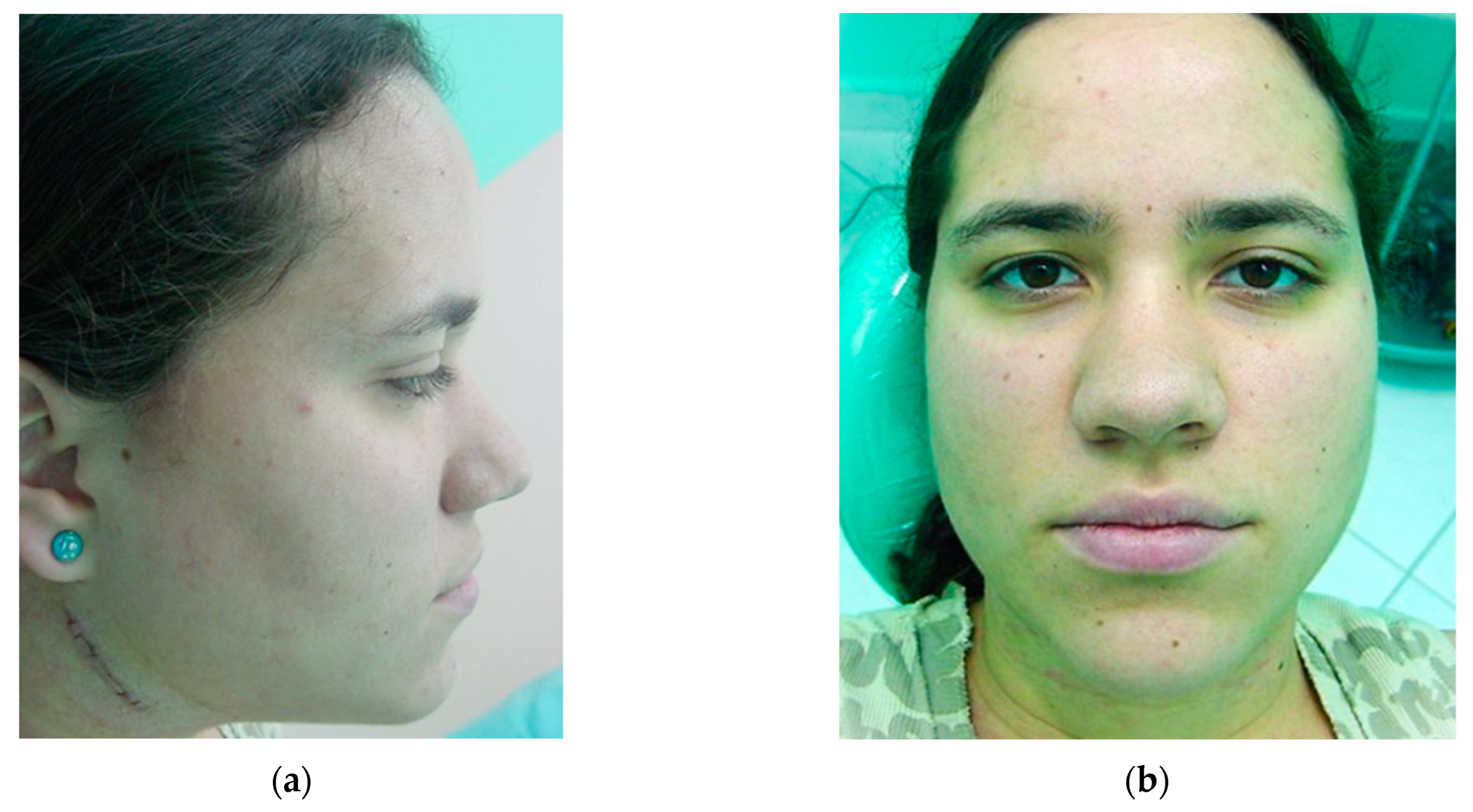 Osteology 04 00002 g017