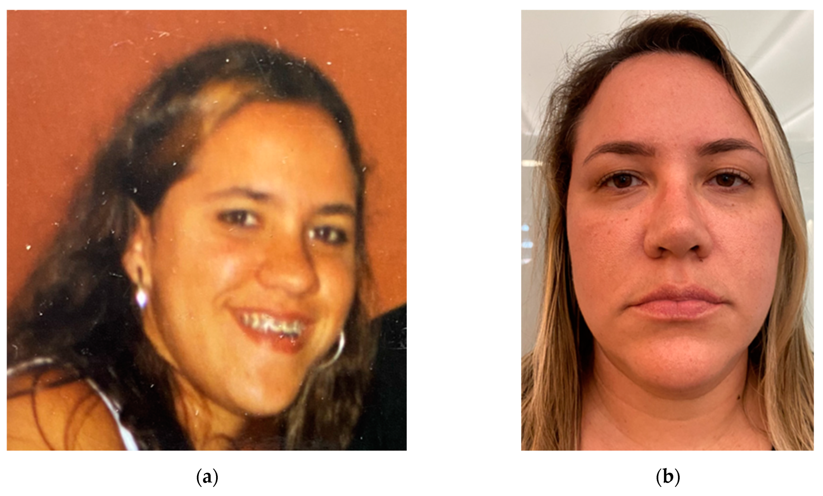 Osteology 04 00002 g018