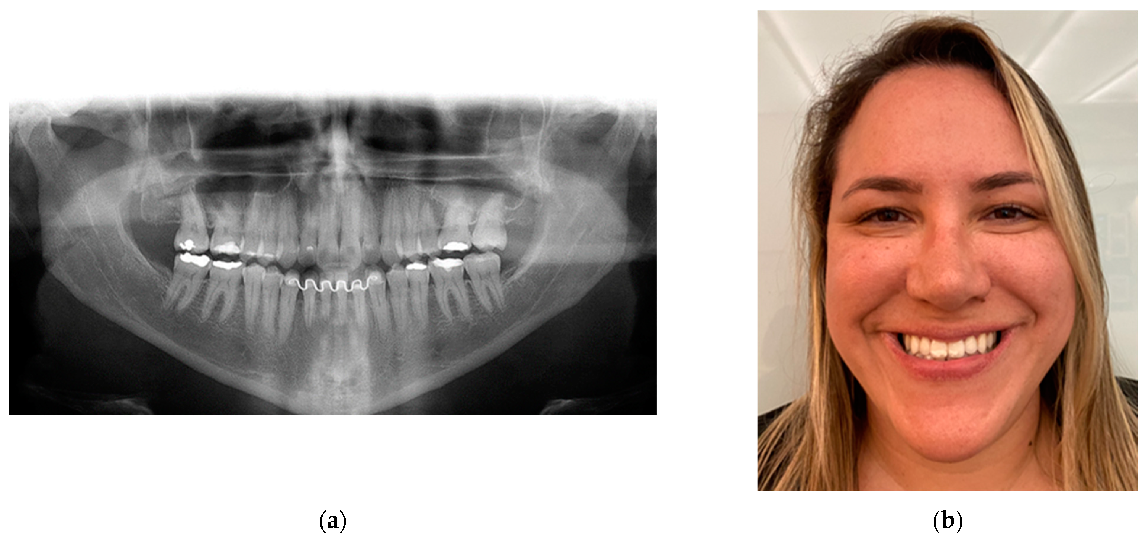 Osteology 04 00002 g019