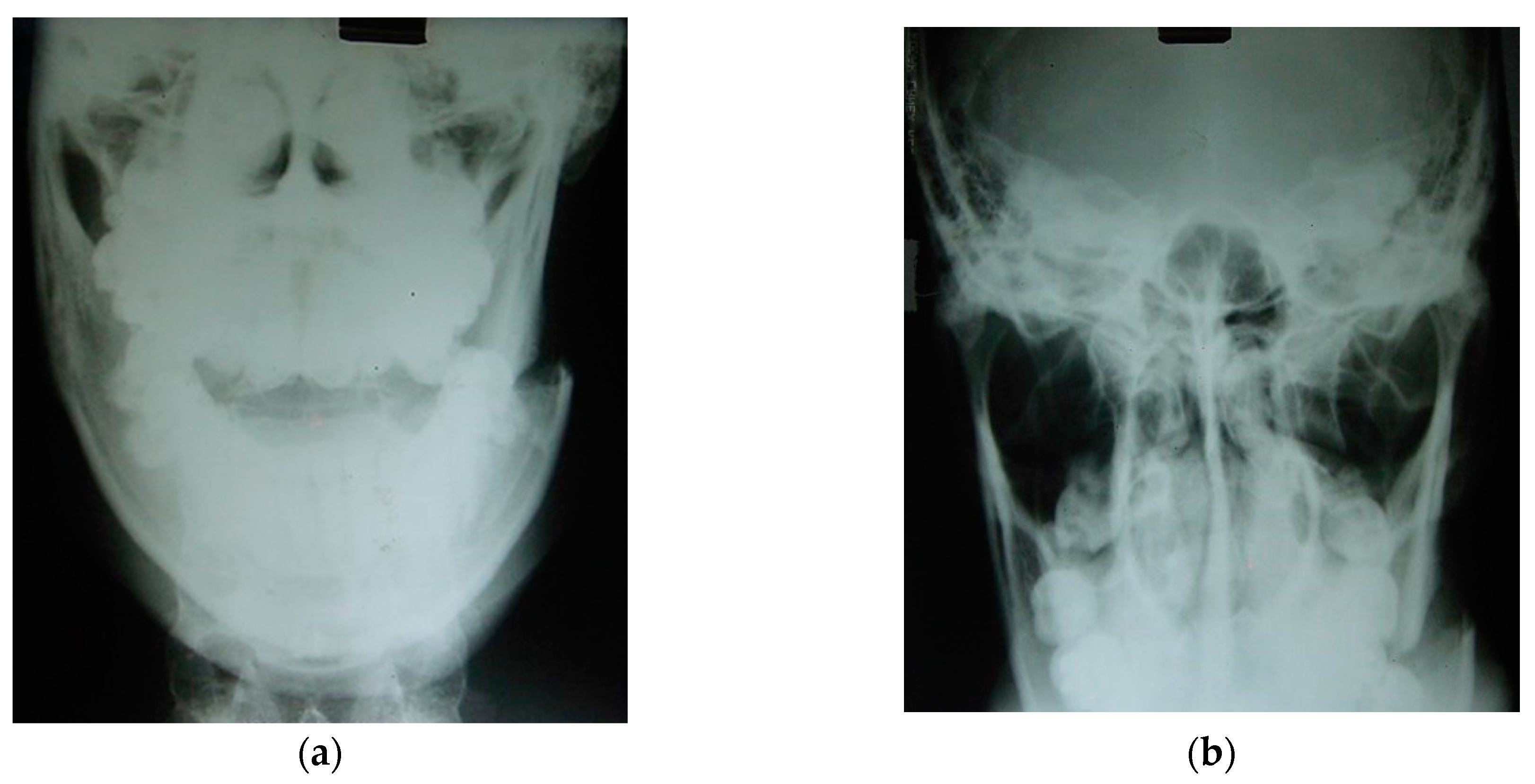 Osteology 04 00002 g020