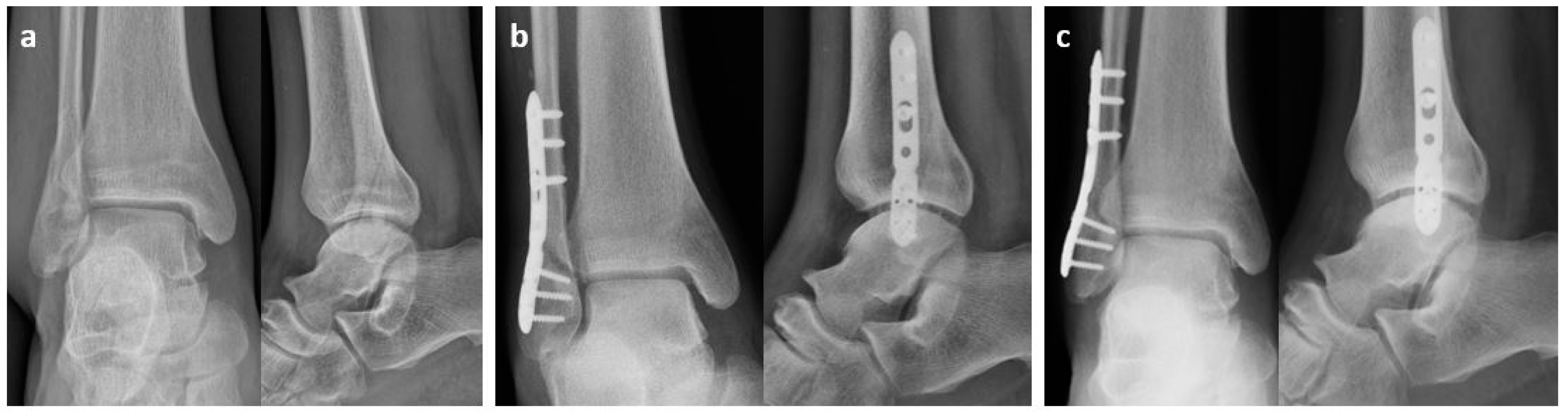 Osteology 04 00012 g003 Osteology 04 00012 g003