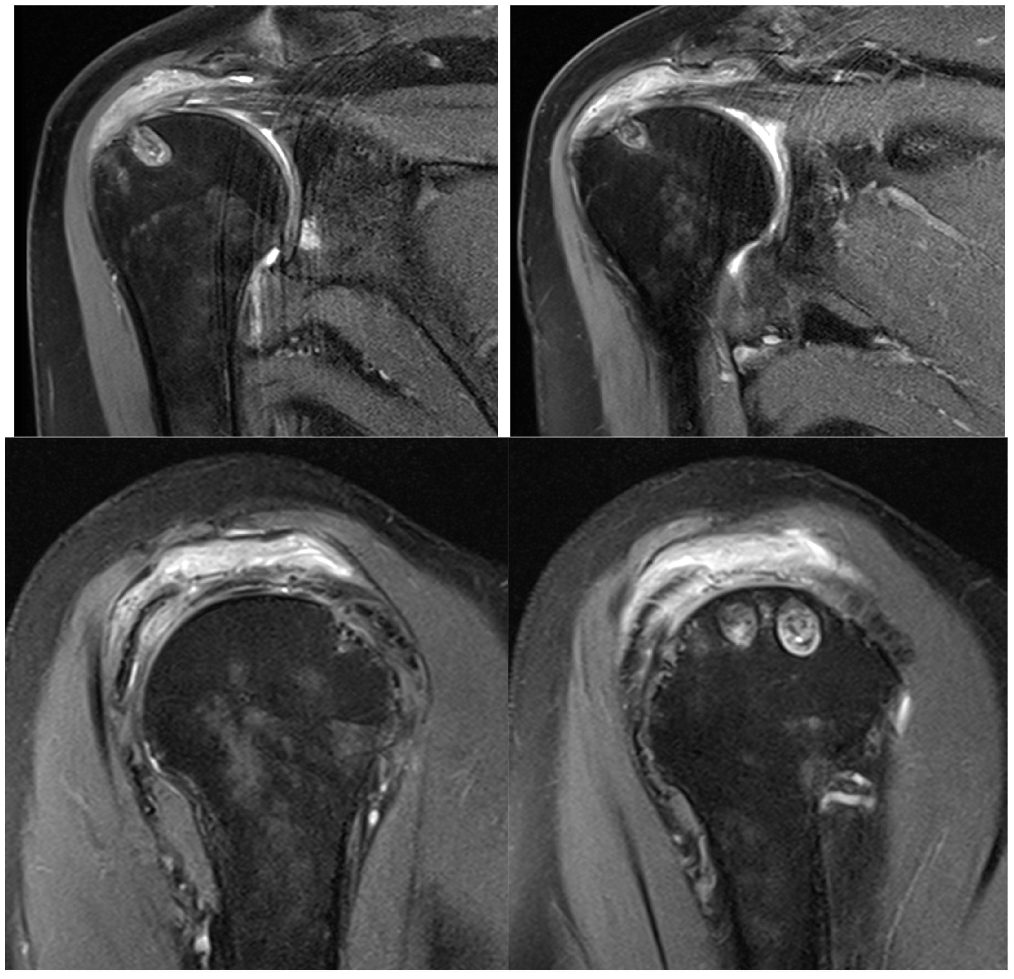 Osteology 05 00012 g009