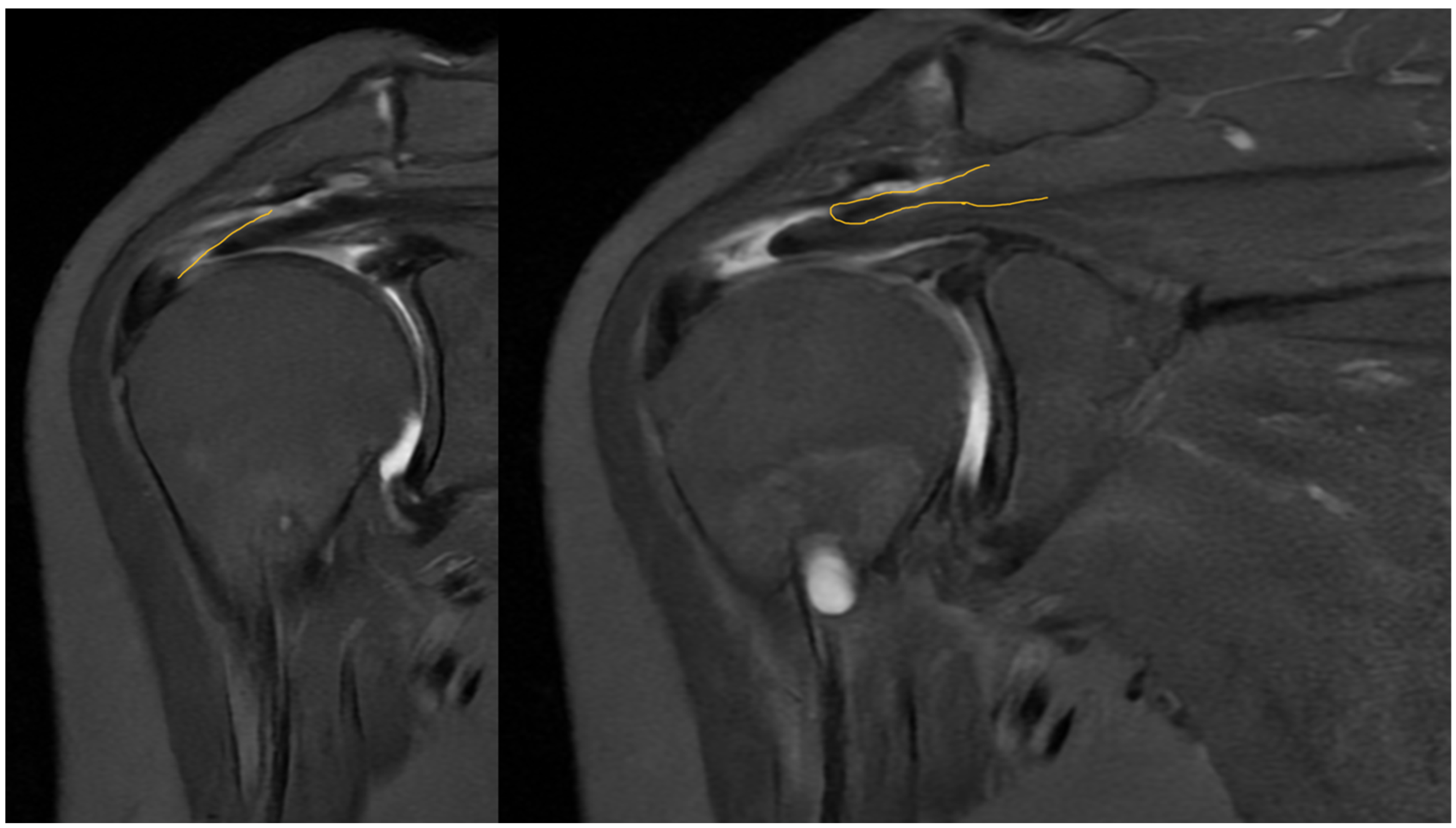 Osteology 05 00012 g012