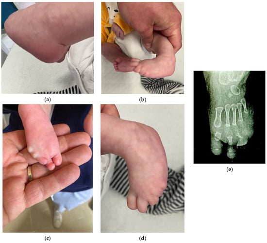 Osteology 05 00021 g001
