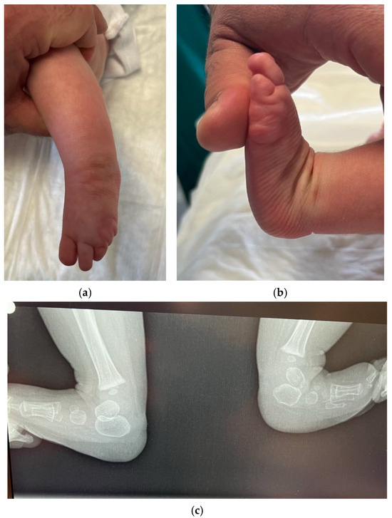 Osteology 05 00021 g002